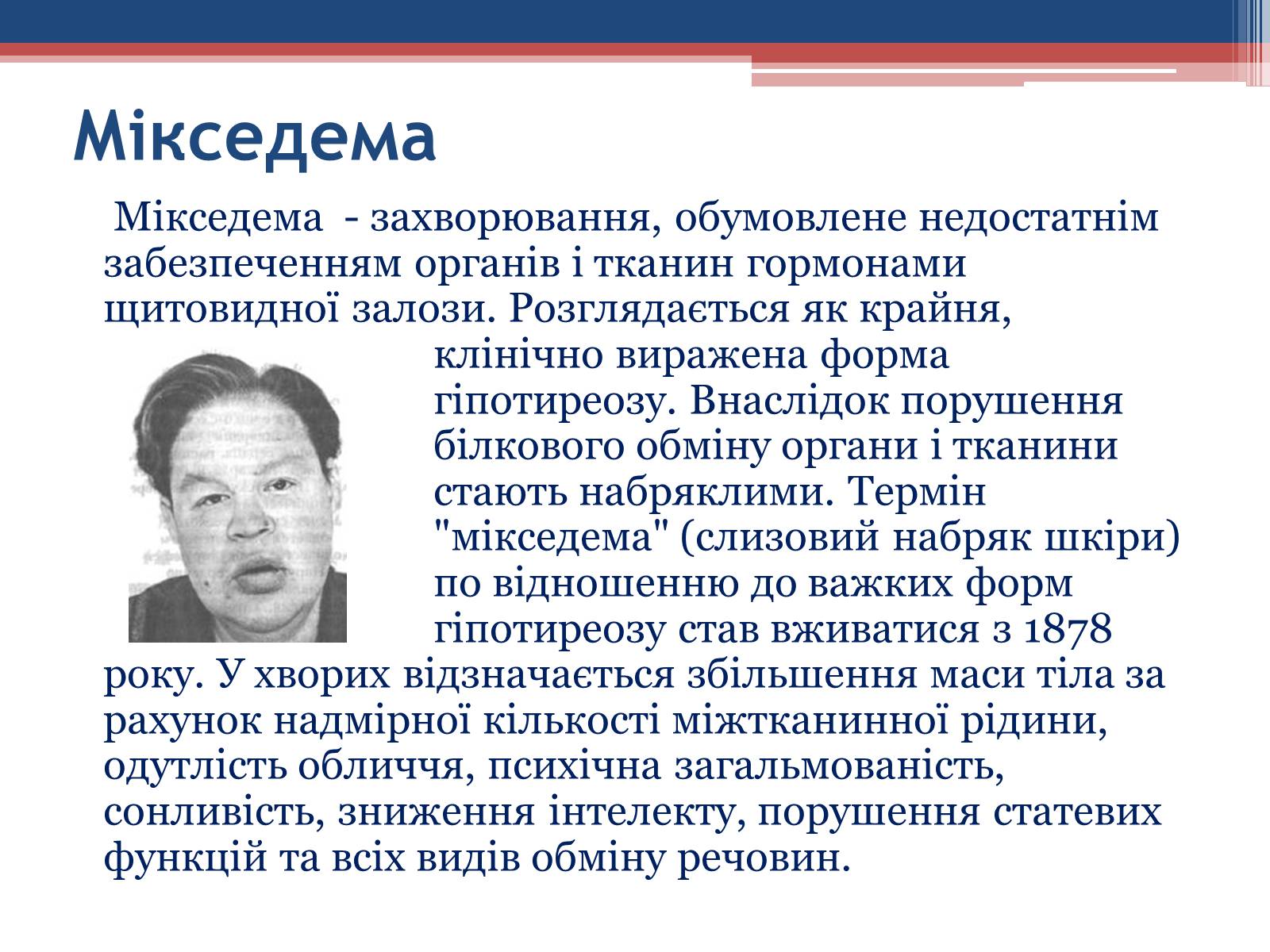 Презентація на тему «Порушення гормональних функцій ендокринних залоз» - Слайд #11 Презентація на тему «Порушення гормональних функцій ендокринних залоз» - Слайд #11