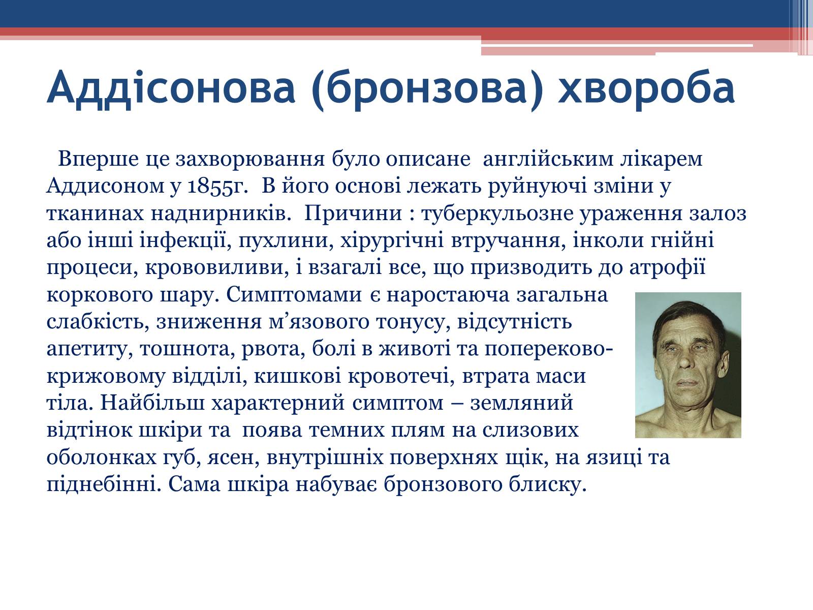 Презентація на тему «Порушення гормональних функцій ендокринних залоз» - Слайд #14 Презентація на тему «Порушення гормональних функцій ендокринних залоз» - Слайд #14