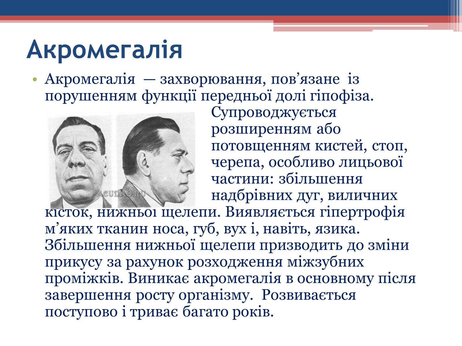 Презентація на тему «Порушення гормональних функцій ендокринних залоз» - Слайд #6 Презентація на тему «Порушення гормональних функцій ендокринних залоз» - Слайд #6