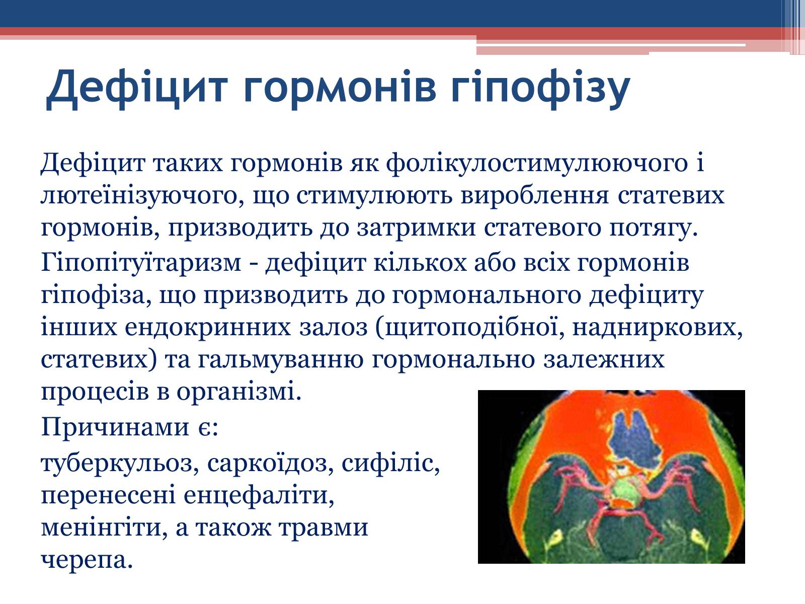 Презентація на тему «Порушення гормональних функцій ендокринних залоз» - Слайд #8 Презентація на тему «Порушення гормональних функцій ендокринних залоз» - Слайд #8