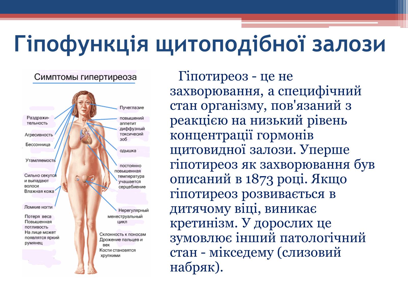 Презентація на тему «Порушення гормональних функцій ендокринних залоз» - Слайд #9 Презентація на тему «Порушення гормональних функцій ендокринних залоз» - Слайд #9