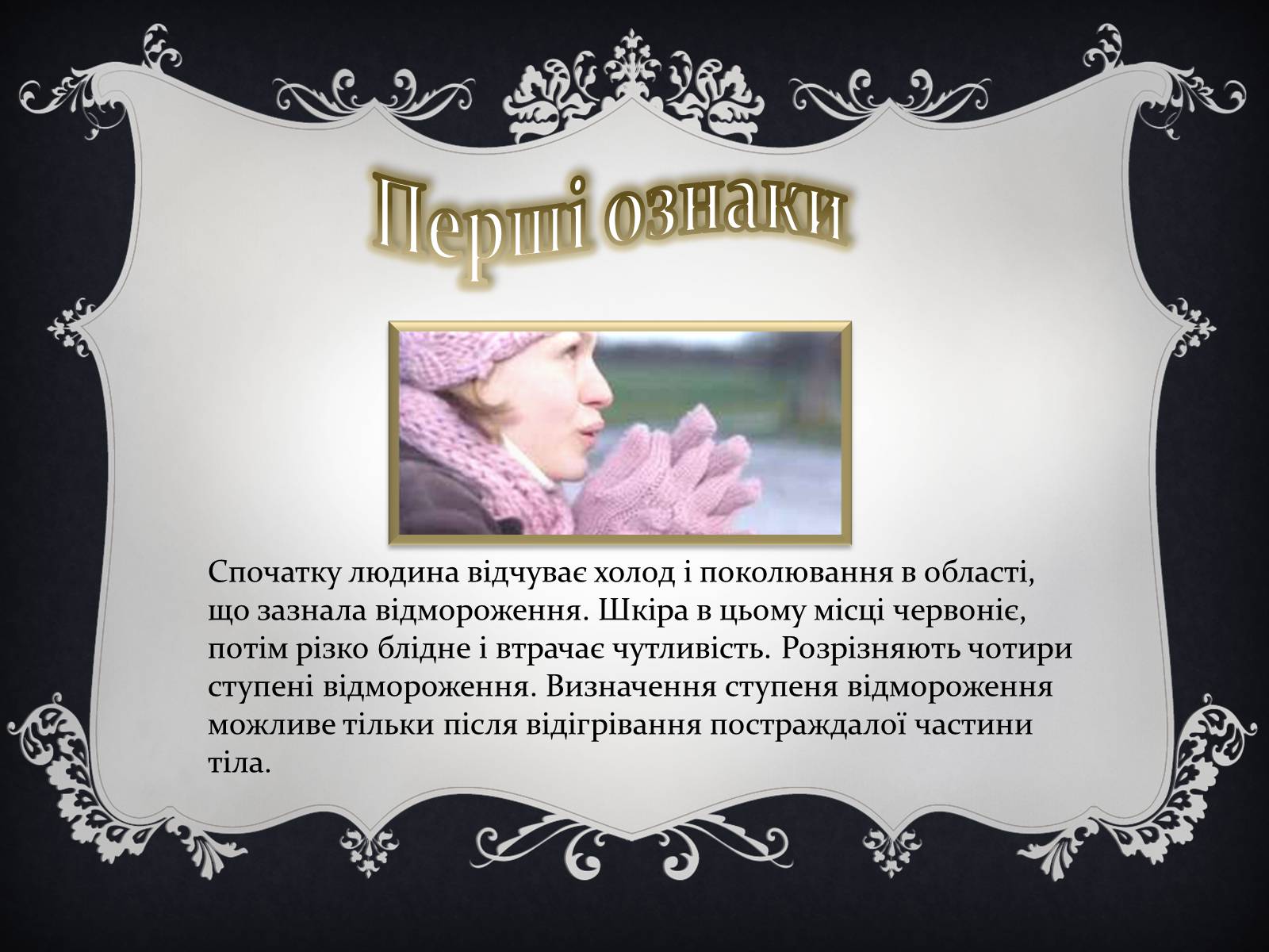 Презентація на тему «Надання першої медичної допомоги притепловомута сонячному ударах, обмороженні та опіках» - Слайд #15 Презентація на тему «Надання першої медичної допомоги притепловомута сонячному ударах, обмороженні та опіках» - Слайд #15