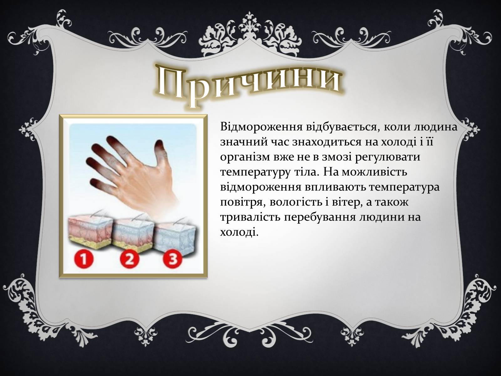 Презентація на тему «Надання першої медичної допомоги притепловомута сонячному ударах, обмороженні та опіках» - Слайд #16 Презентація на тему «Надання першої медичної допомоги притепловомута сонячному ударах, обмороженні та опіках» - Слайд #16