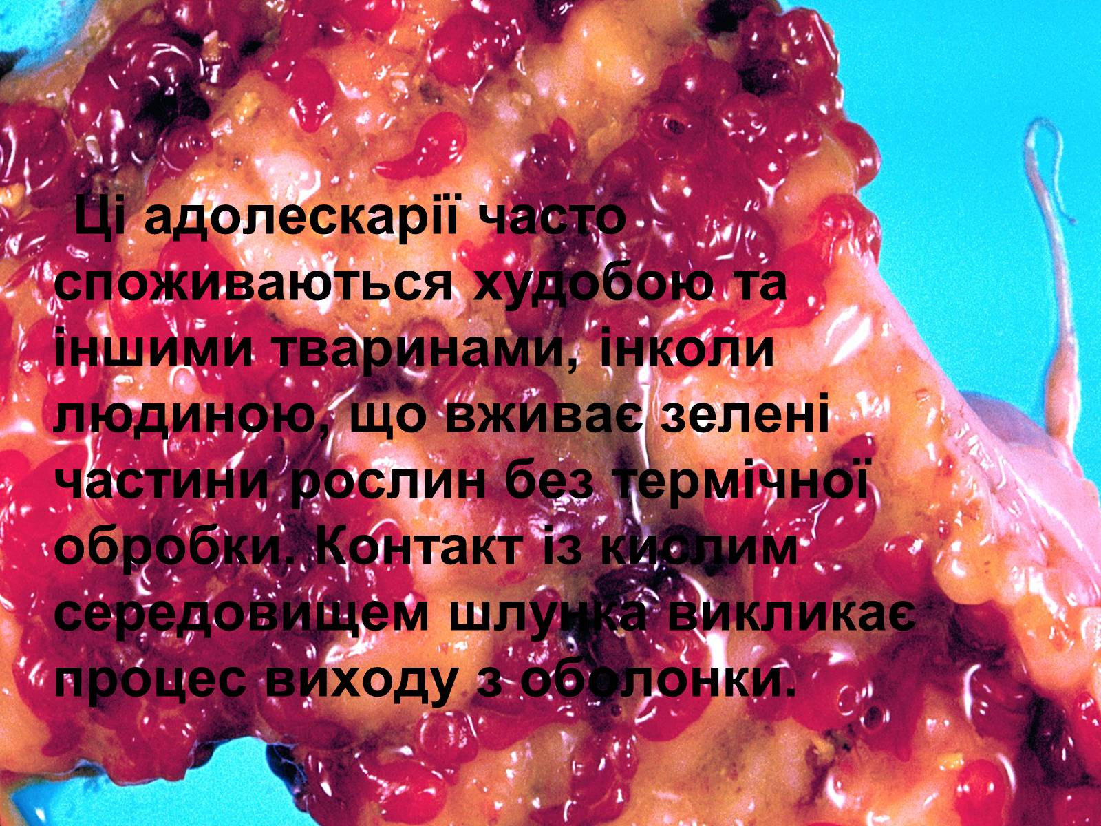 Презентація на тему «Життєвий цикл печінкового сисуна» - Слайд #7