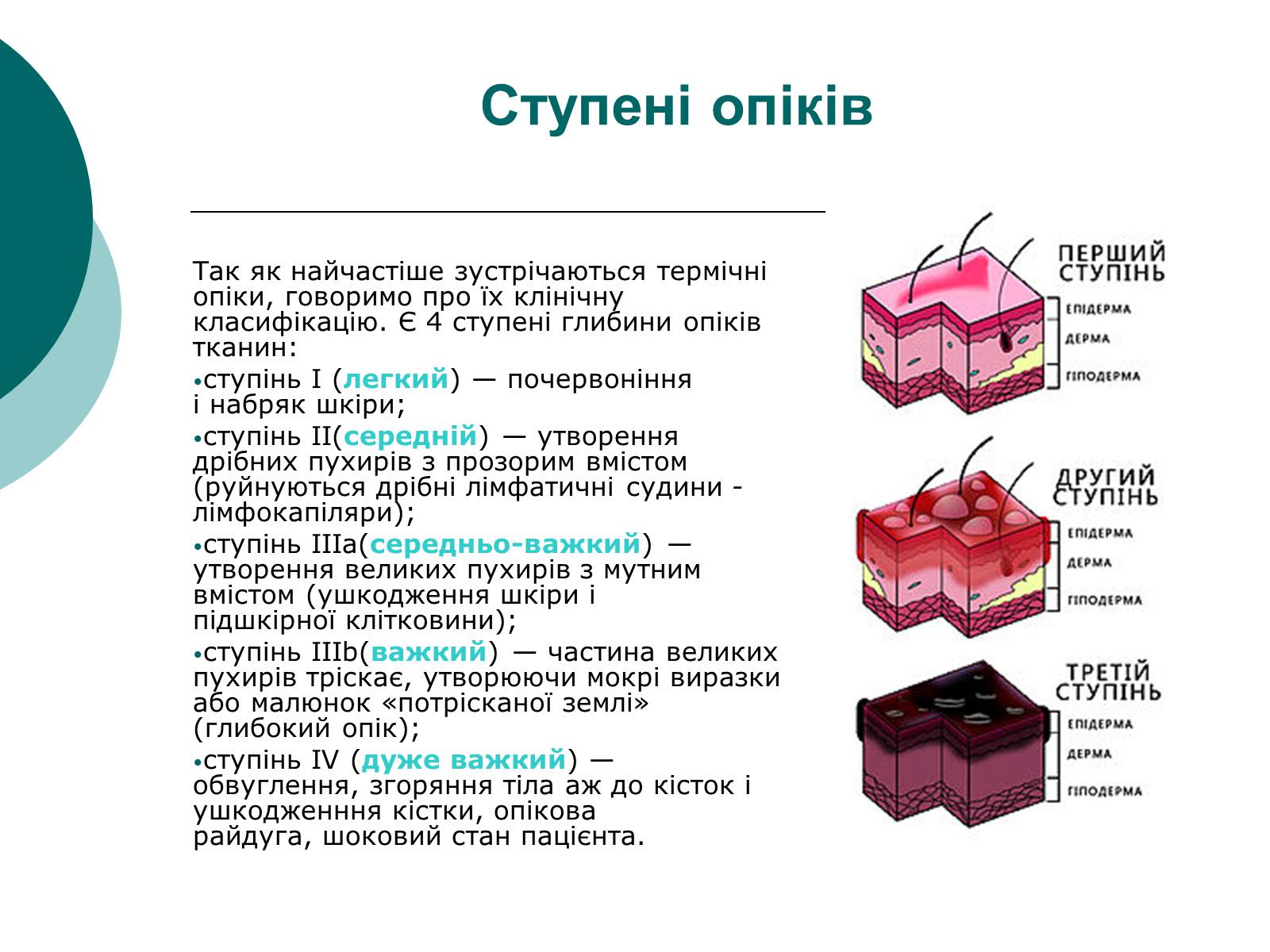 Презентація на тему «Опіки» (варіант 4) - Слайд #3 Презентація на тему «Опіки» (варіант 4) - Слайд #3