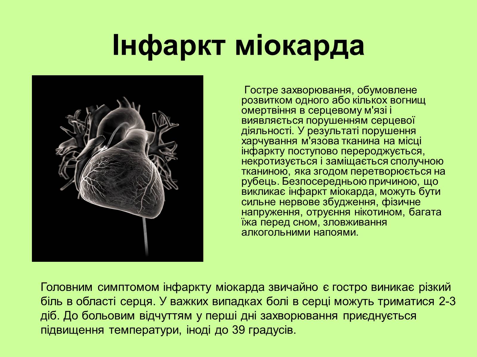 Презентація на тему «Хвороби серцево-судинної системи» (варіант 1) - Слайд #2 Презентація на тему «Хвороби серцево-судинної системи» (варіант 1) - Слайд #2
