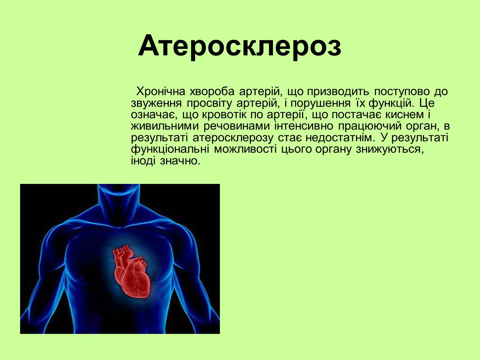 Презентація на тему «Хвороби серцево-судинної системи» (варіант 1) - Слайд #4 Презентація на тему «Хвороби серцево-судинної системи» (варіант 1) - Слайд #4