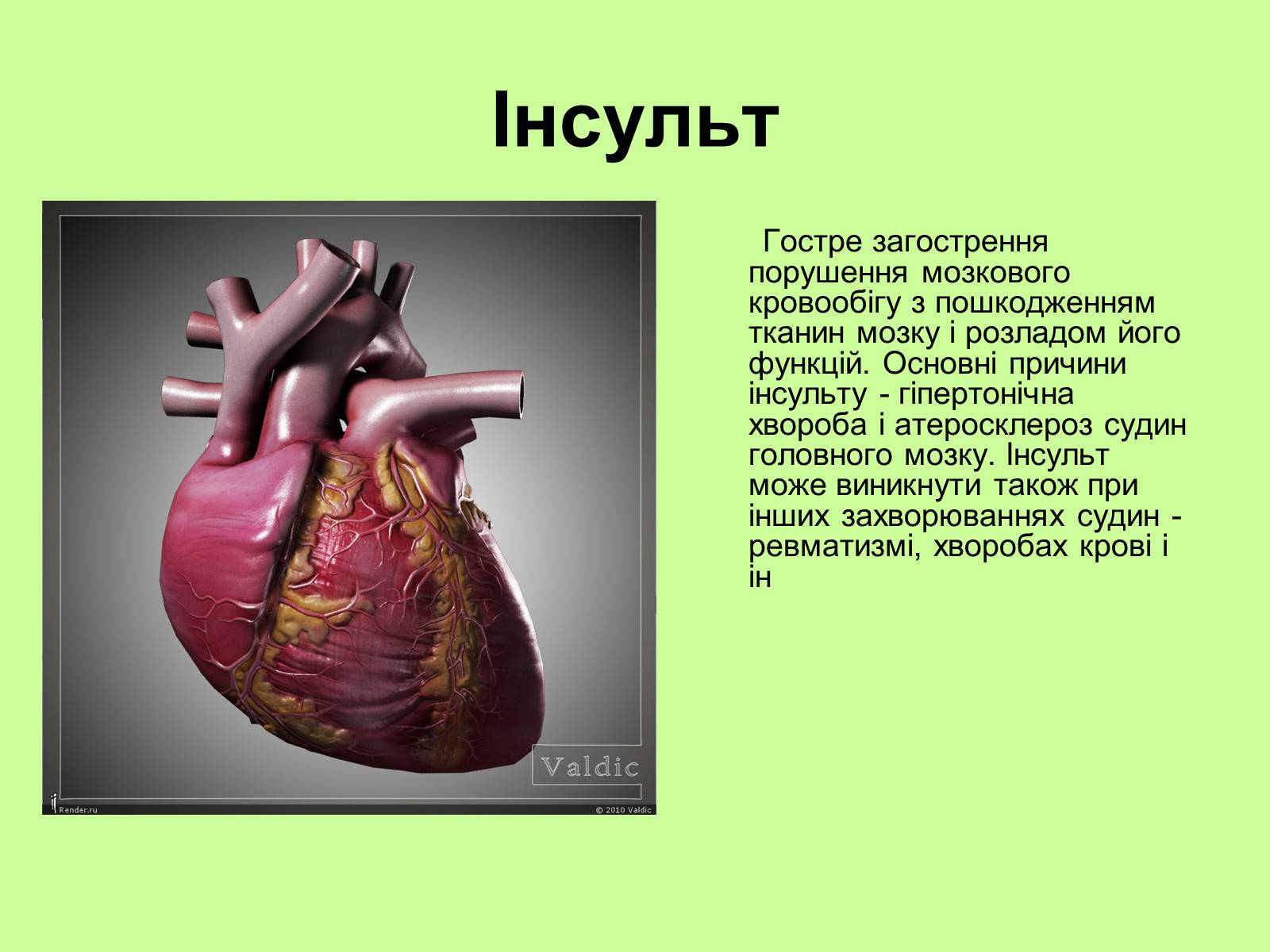 Презентація на тему «Хвороби серцево-судинної системи» (варіант 1) - Слайд #7 Презентація на тему «Хвороби серцево-судинної системи» (варіант 1) - Слайд #7