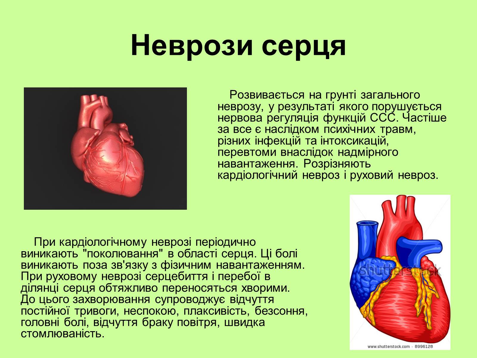 Презентація на тему «Хвороби серцево-судинної системи» (варіант 1) - Слайд #8 Презентація на тему «Хвороби серцево-судинної системи» (варіант 1) - Слайд #8