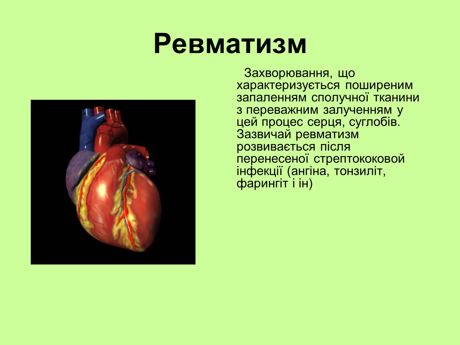 Презентація на тему «Хвороби серцево-судинної системи» (варіант 1) - Слайд #9 Презентація на тему «Хвороби серцево-судинної системи» (варіант 1) - Слайд #9