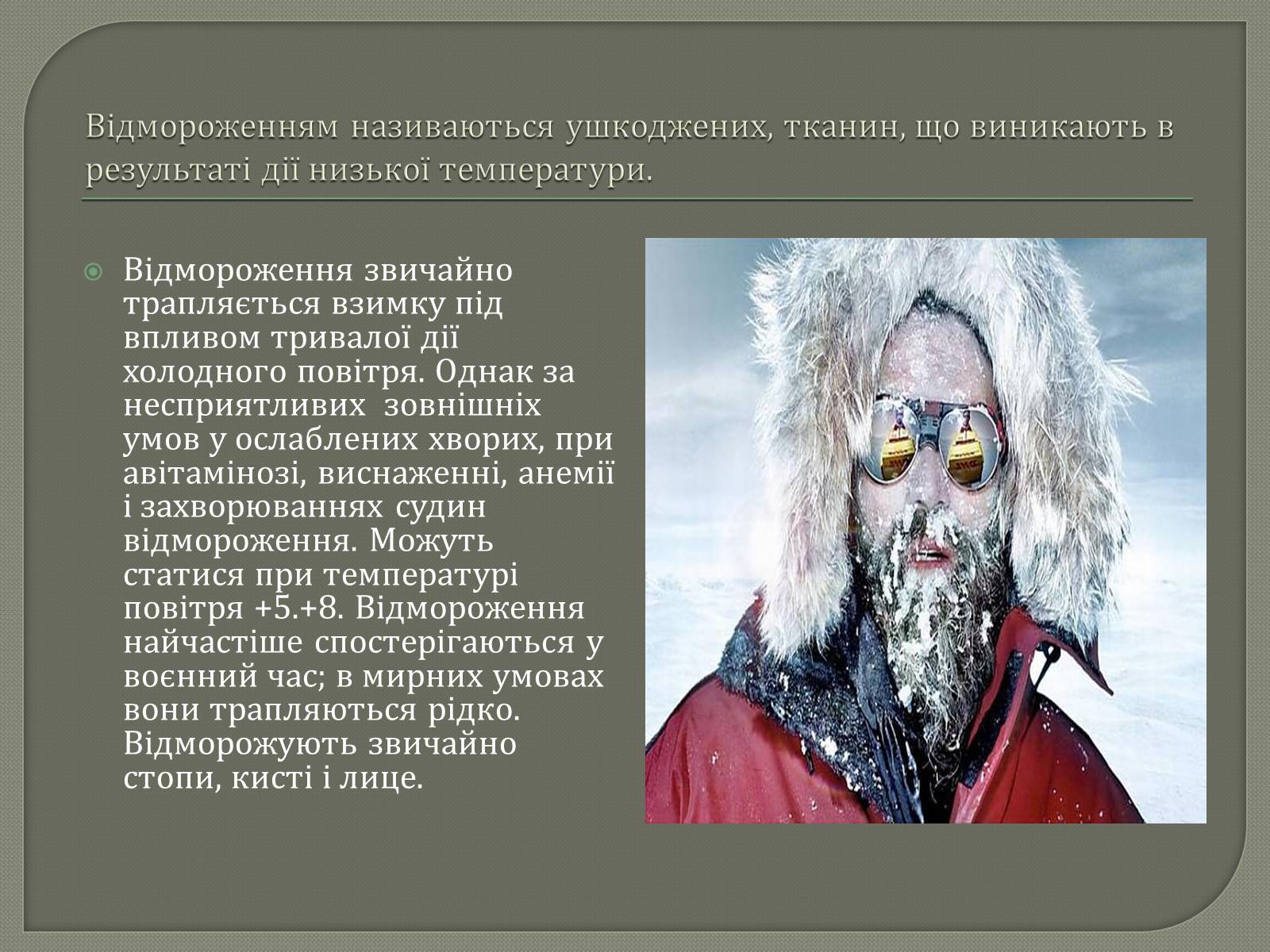 Презентація на тему «Відмороження» - Слайд #2 Презентація на тему «Відмороження» - Слайд #2