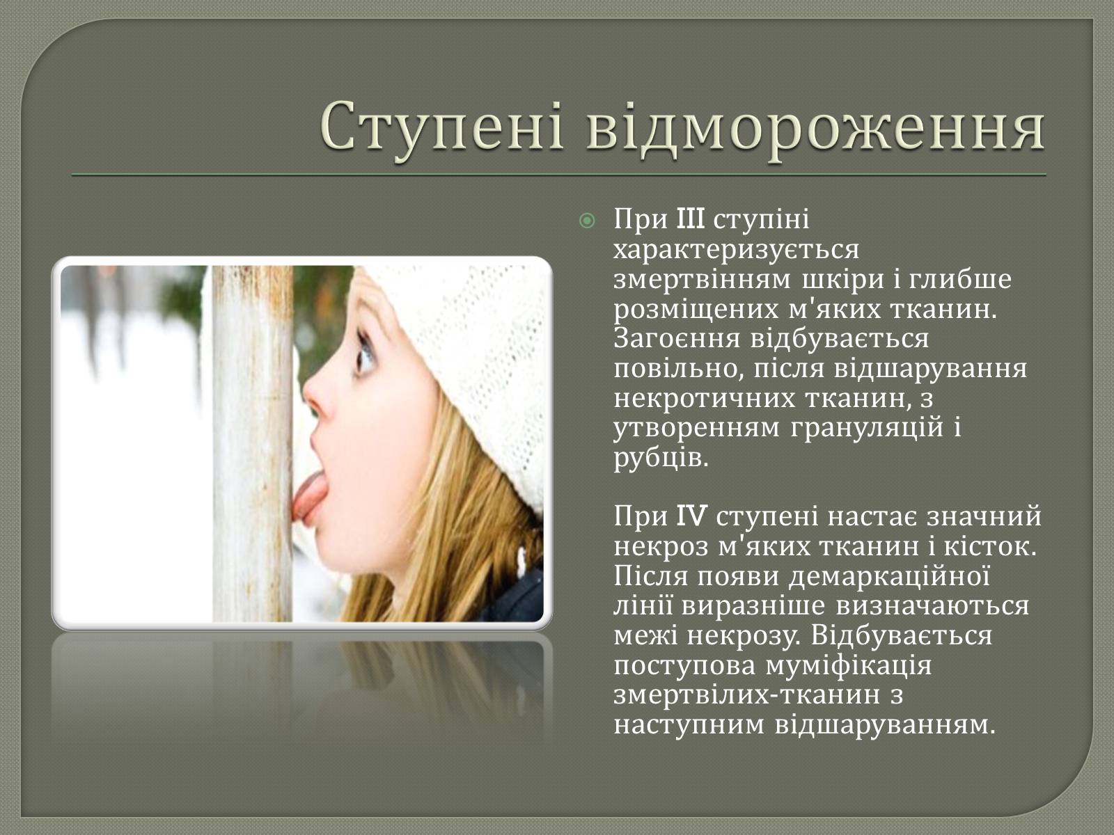 Презентація на тему «Відмороження» - Слайд #5 Презентація на тему «Відмороження» - Слайд #5