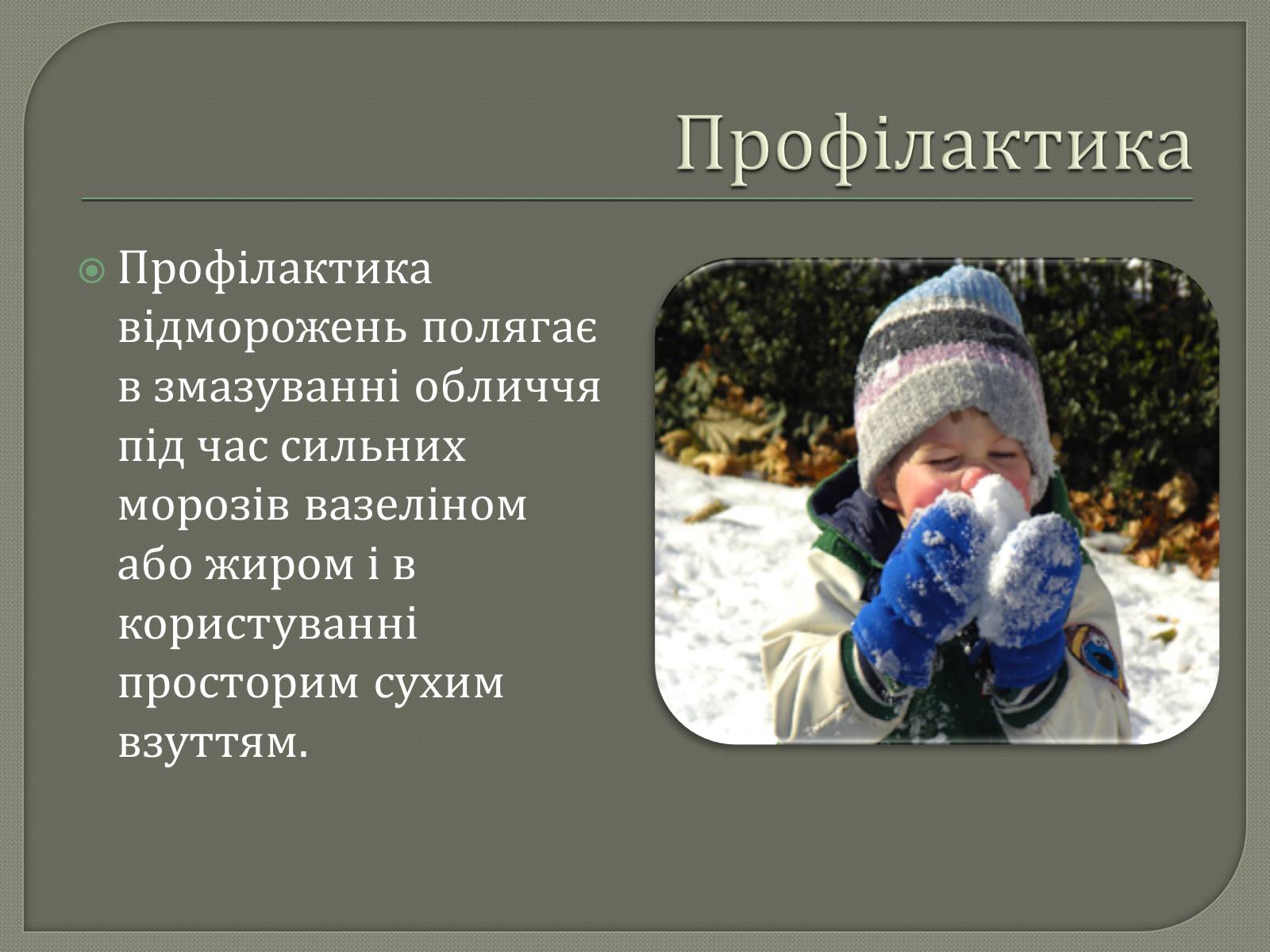 Презентація на тему «Відмороження» - Слайд #9 Презентація на тему «Відмороження» - Слайд #9