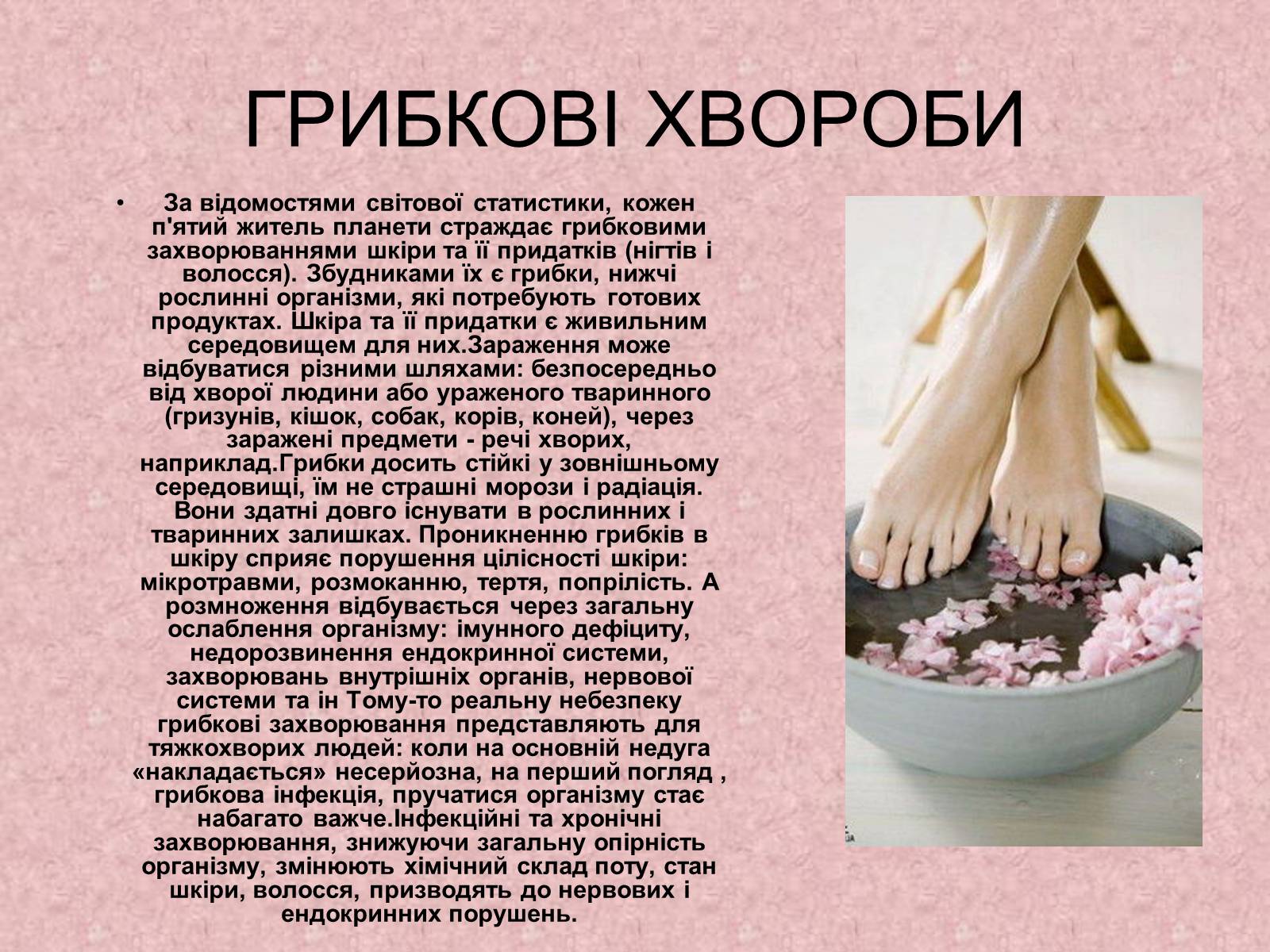 Презентація на тему «Поширення небезпечних хвороб» - Слайд #5 Презентація на тему «Поширення небезпечних хвороб» - Слайд #5