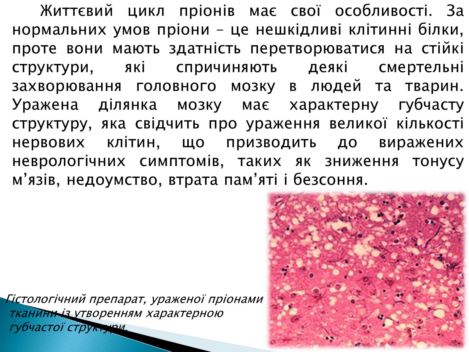 Презентація на тему «Неклітинні форми життя: пріони» - Слайд #3 Презентація на тему «Неклітинні форми життя: пріони» - Слайд #3