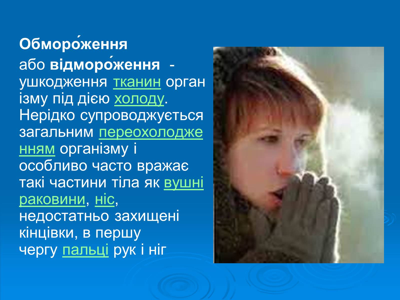 Презентація на тему «Обмороженя» - Слайд #2 Презентація на тему «Обмороженя» - Слайд #2