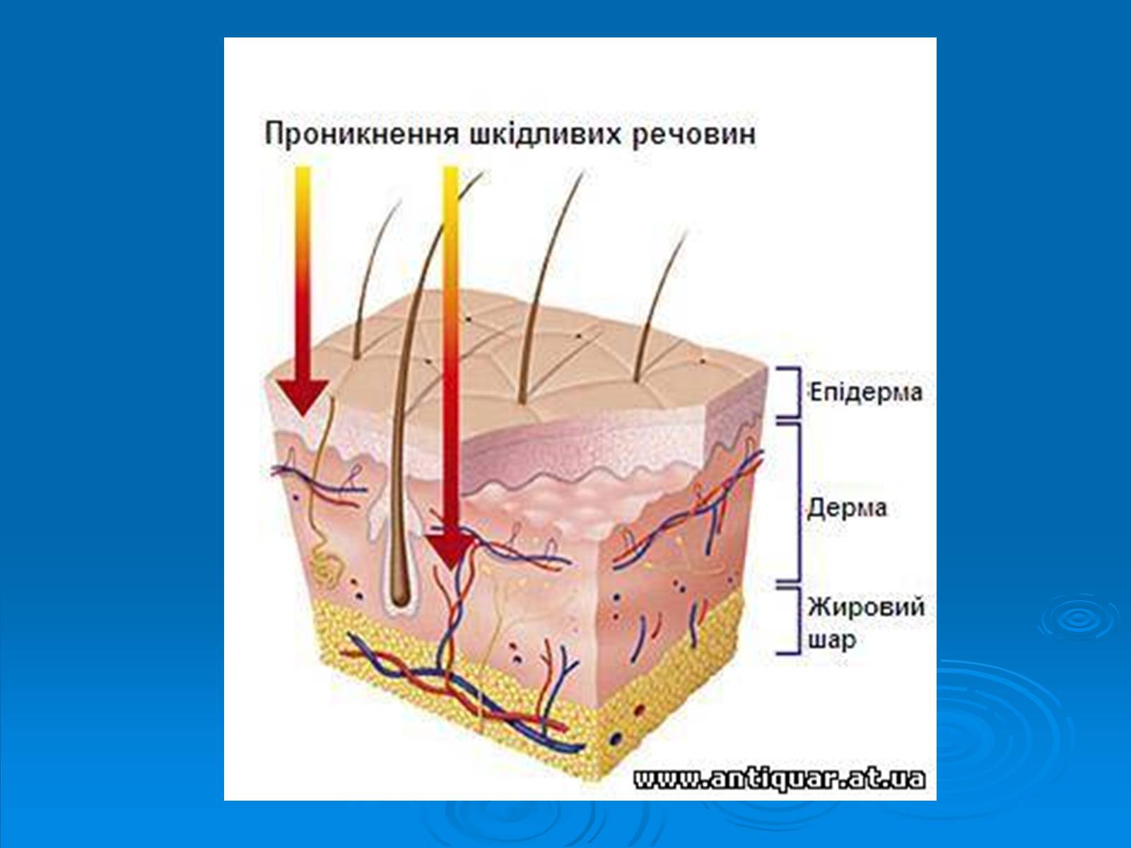 Презентація на тему «Обмороженя» - Слайд #4 Презентація на тему «Обмороженя» - Слайд #4