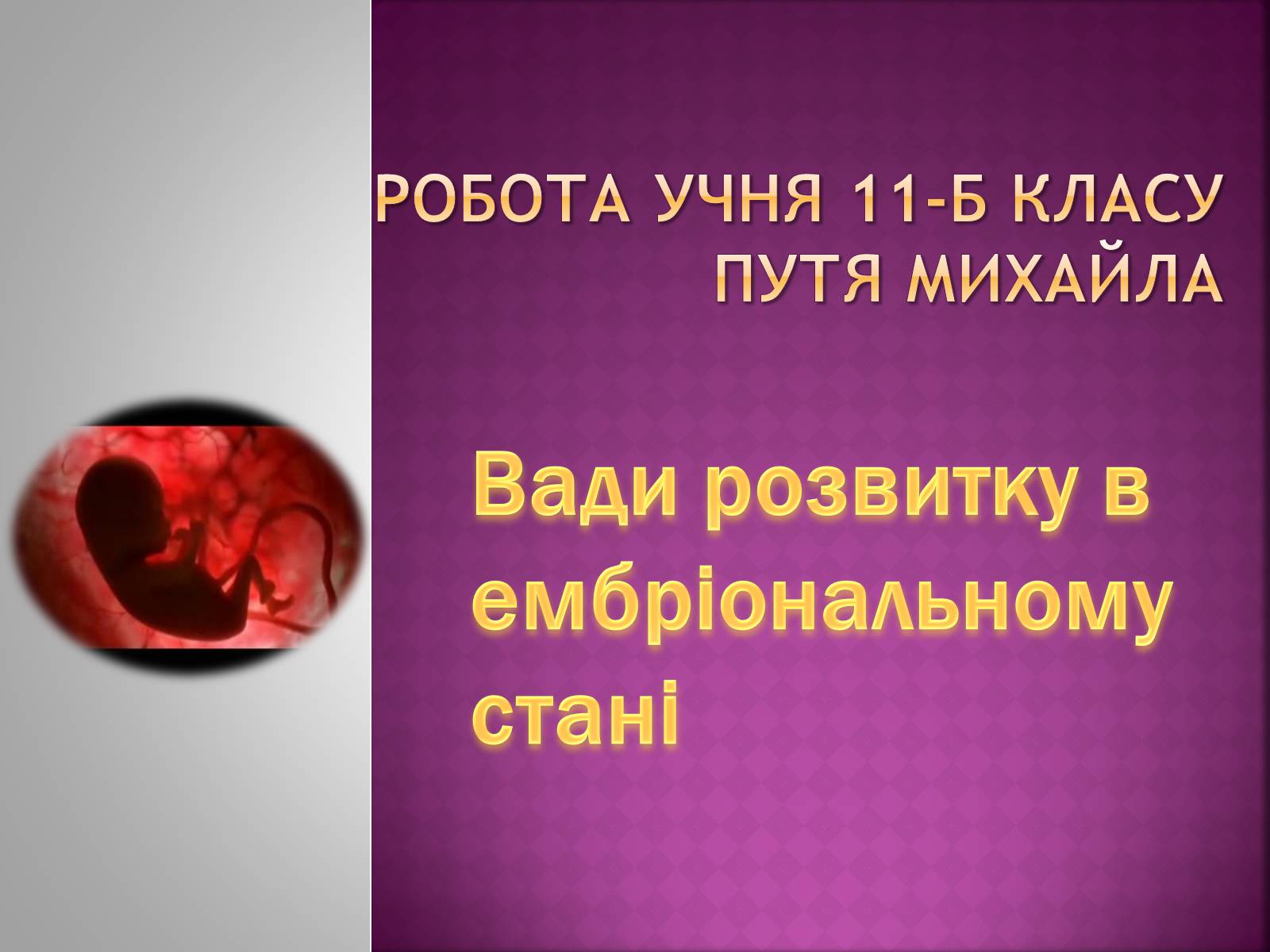 Презентація на тему «Вади розвитку в ембріональному стані» - Слайд #1 Презентація на тему «Вади розвитку в ембріональному стані» - Слайд #1