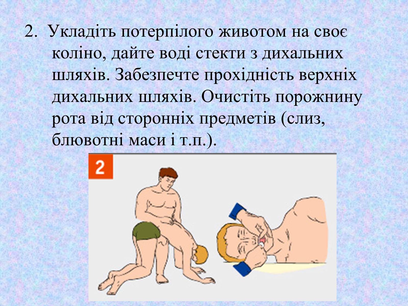 Презентація на тему «Перша допомога при утопленні» (варіант 2) - Слайд #5 Презентація на тему «Перша допомога при утопленні» (варіант 2) - Слайд #5