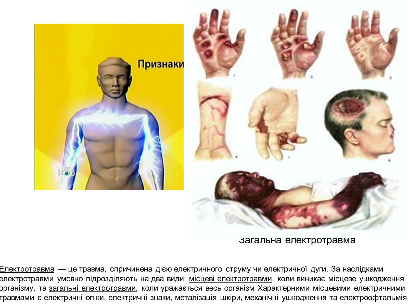 Презентація на тему «Електричний опік» - Слайд #2 Презентація на тему «Електричний опік» - Слайд #2