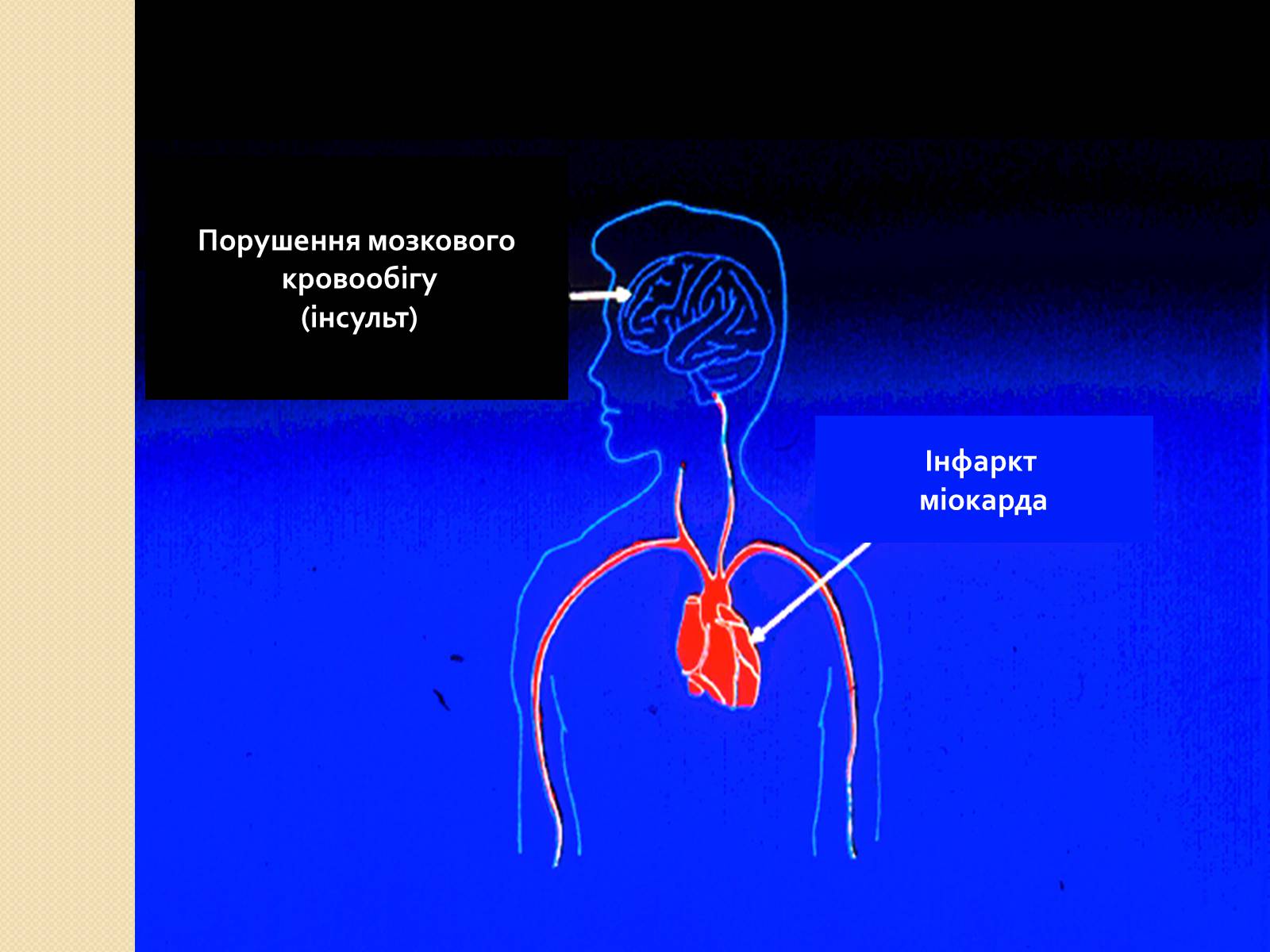 Презентація на тему «Палити чи не палити?» - Слайд #8 Презентація на тему «Палити чи не палити?» - Слайд #8