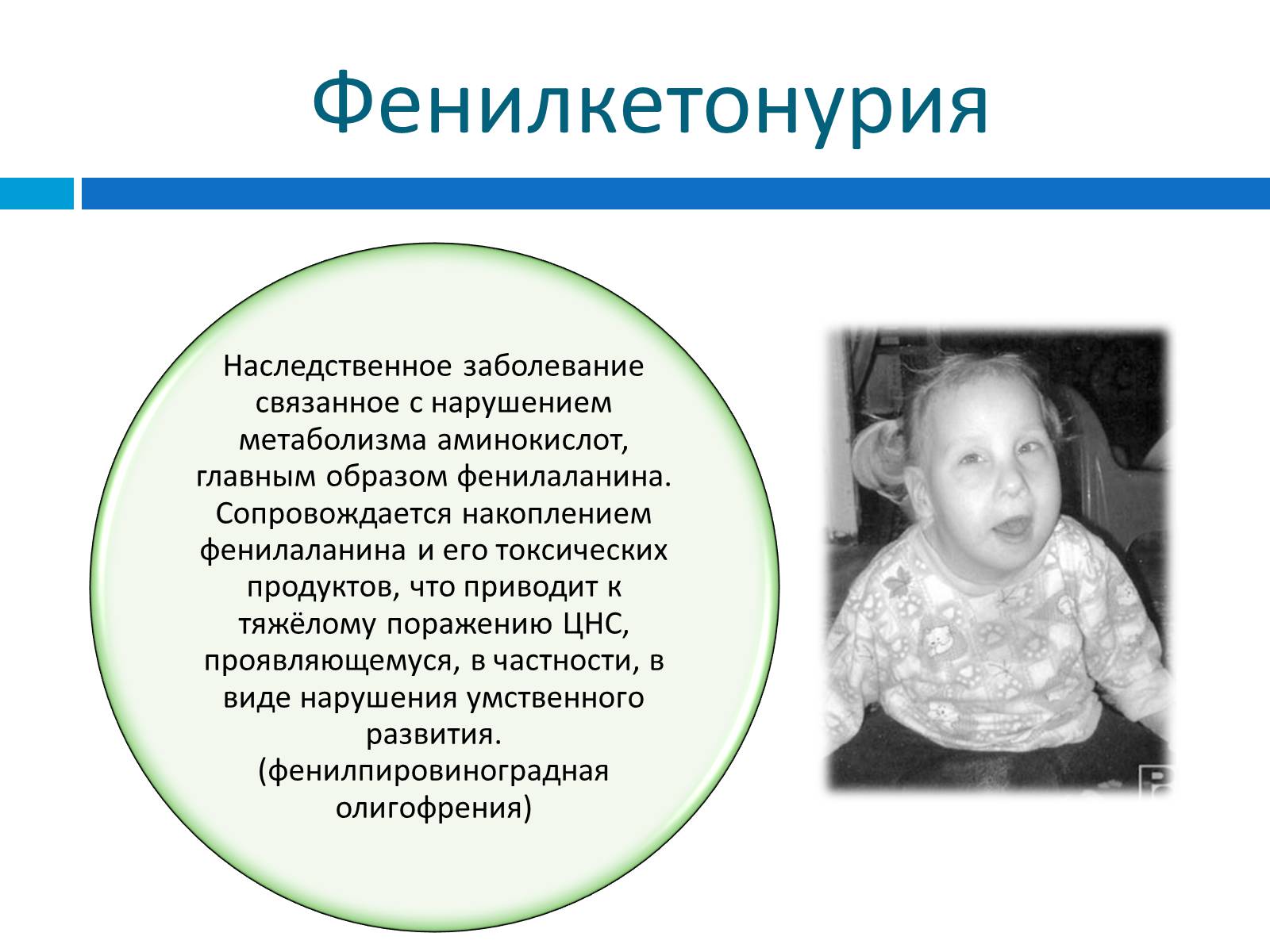 Презентація на тему «Генетика» (варіант 8) - Слайд #14 Презентація на тему «Генетика» (варіант 8) - Слайд #14