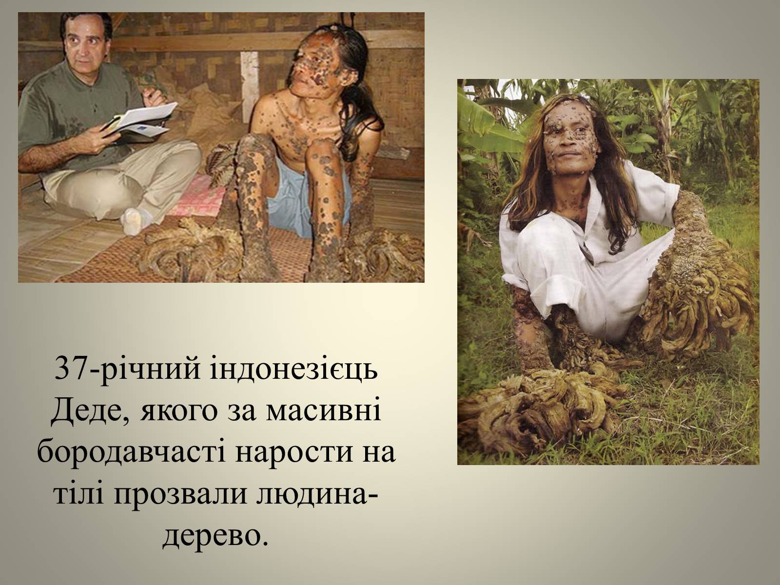 Презентація на тему «Мутації» (варіант 3) - Слайд #7 Презентація на тему «Мутації» (варіант 3) - Слайд #7