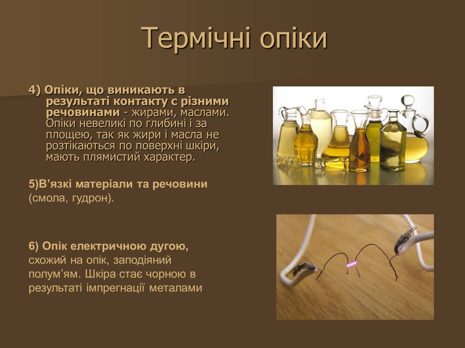 Презентація на тему «Опіки» (варіант 3) - Слайд #4 Презентація на тему «Опіки» (варіант 3) - Слайд #4