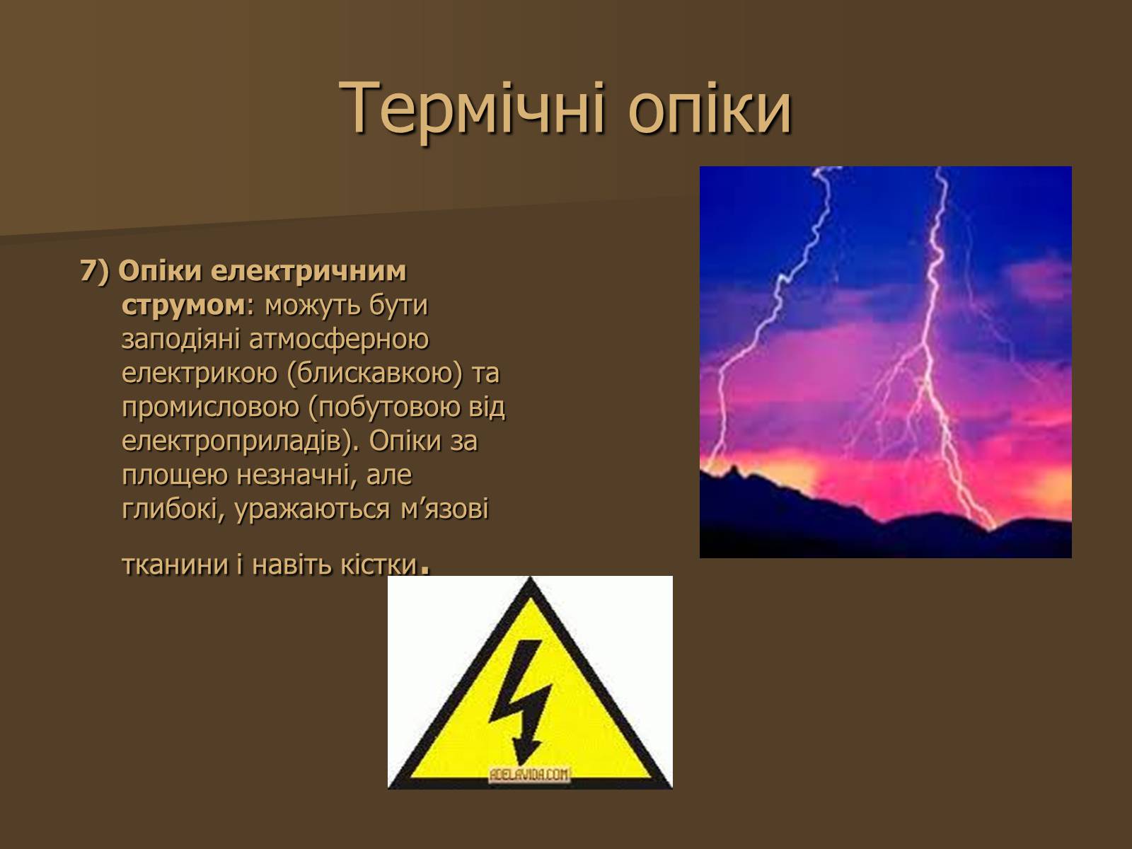 Презентація на тему «Опіки» (варіант 3) - Слайд #5 Презентація на тему «Опіки» (варіант 3) - Слайд #5