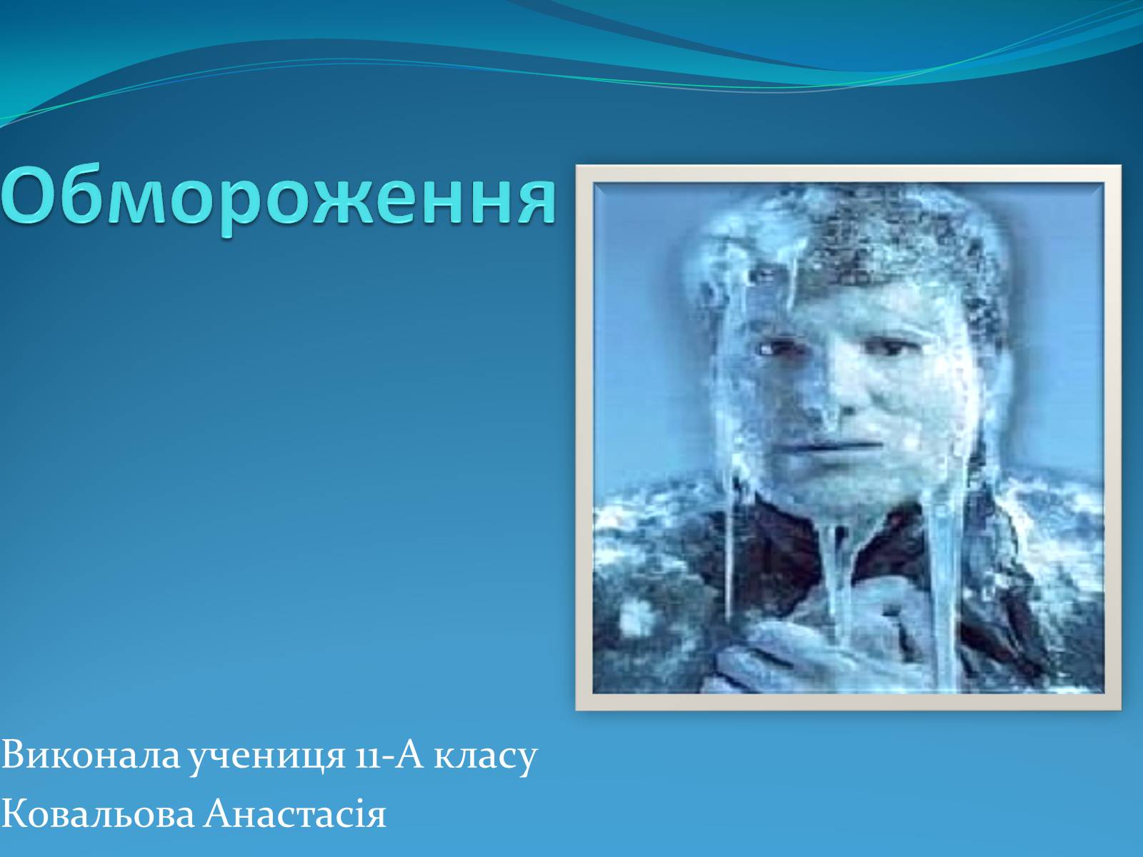 Презентація на тему «Обмороження» (варіант 3) - Слайд #1 Презентація на тему «Обмороження» (варіант 3) - Слайд #1