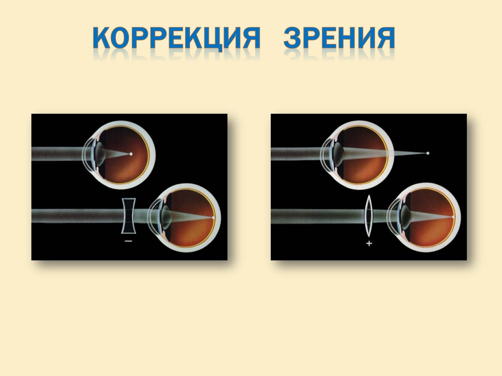 Презентація на тему «Гигиена зрения» - Слайд #13 Презентація на тему «Гигиена зрения» - Слайд #13