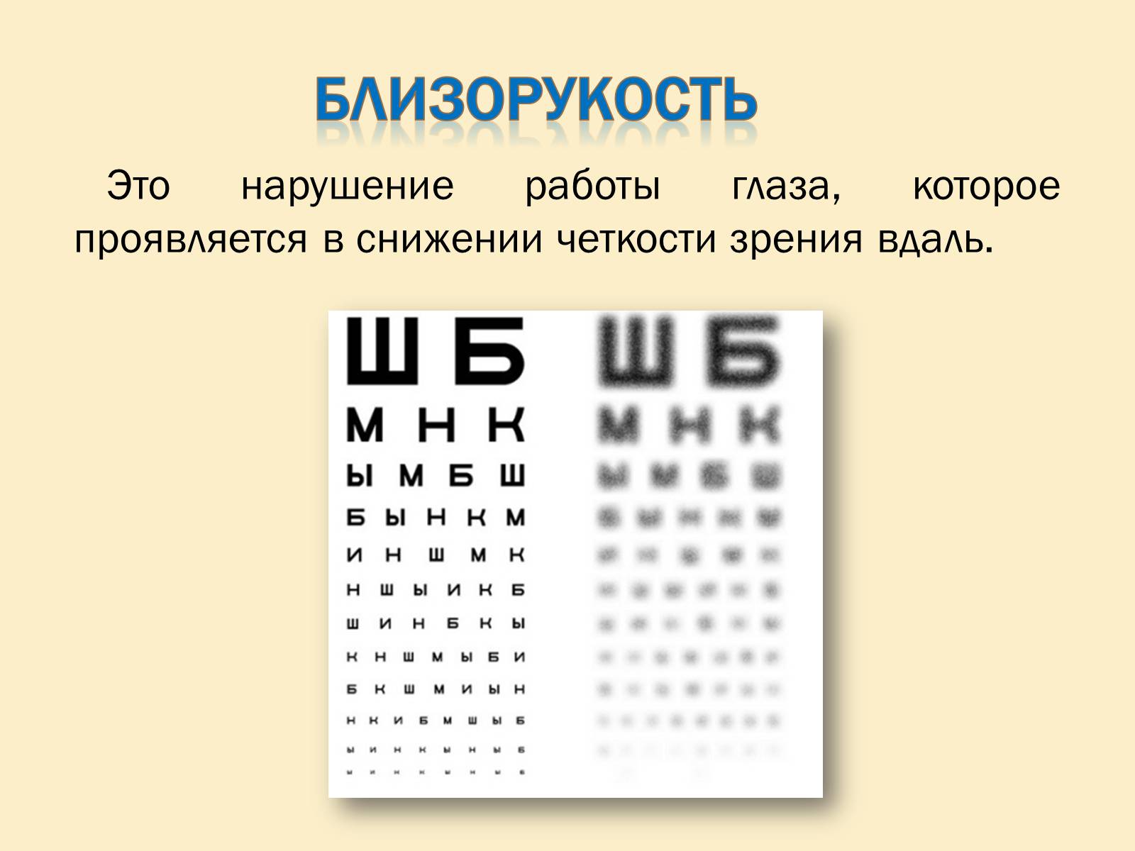 Презентація на тему «Гигиена зрения» - Слайд #4 Презентація на тему «Гигиена зрения» - Слайд #4
