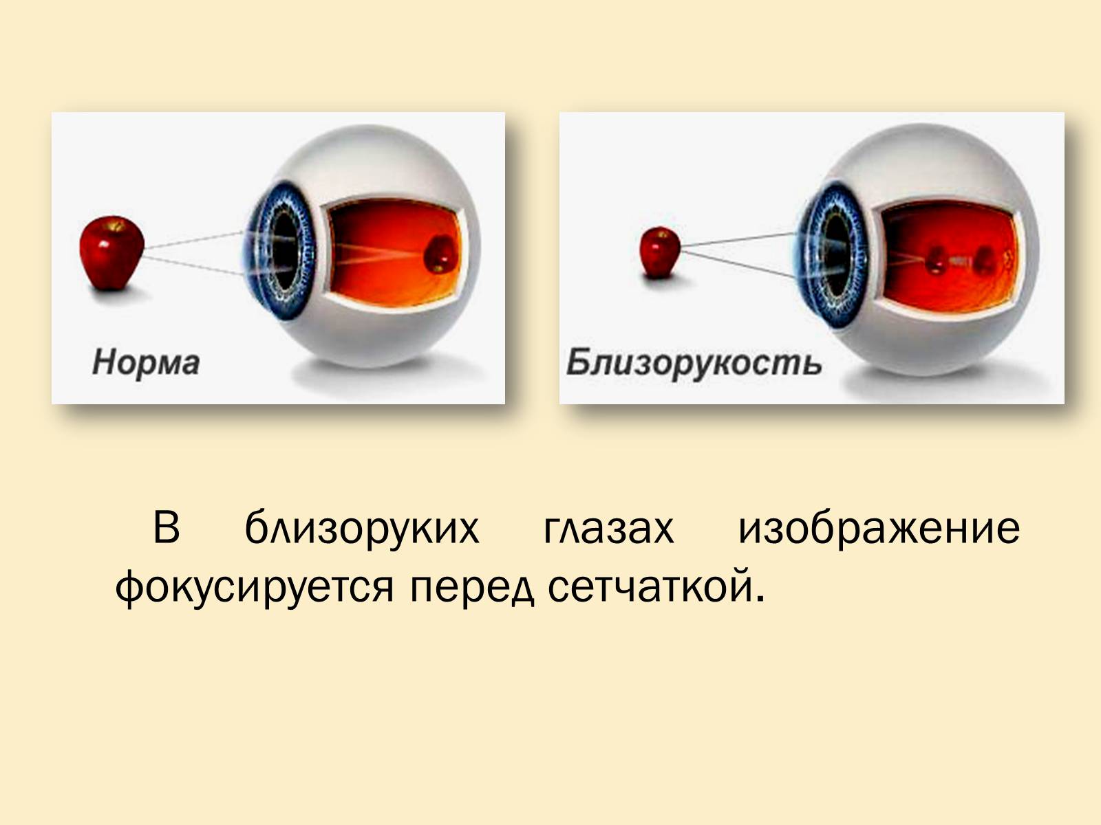 Презентація на тему «Гигиена зрения» - Слайд #5 Презентація на тему «Гигиена зрения» - Слайд #5