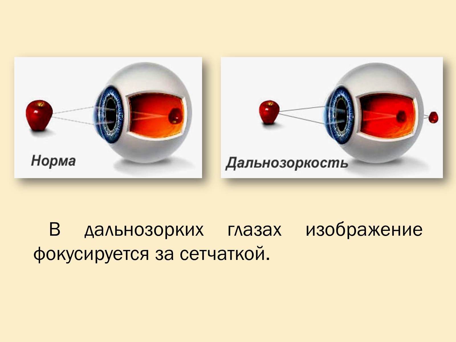 Презентація на тему «Гигиена зрения» - Слайд #9 Презентація на тему «Гигиена зрения» - Слайд #9