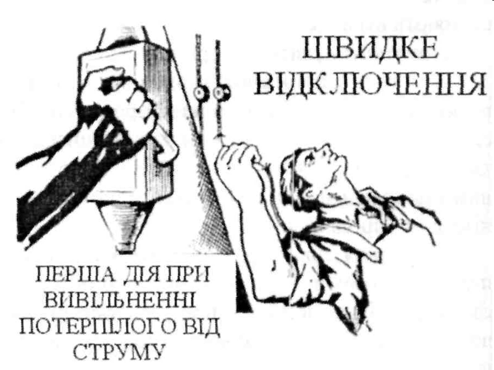 Презентація на тему «Електротравми» (варіант 1) - Слайд #14 Презентація на тему «Електротравми» (варіант 1) - Слайд #14