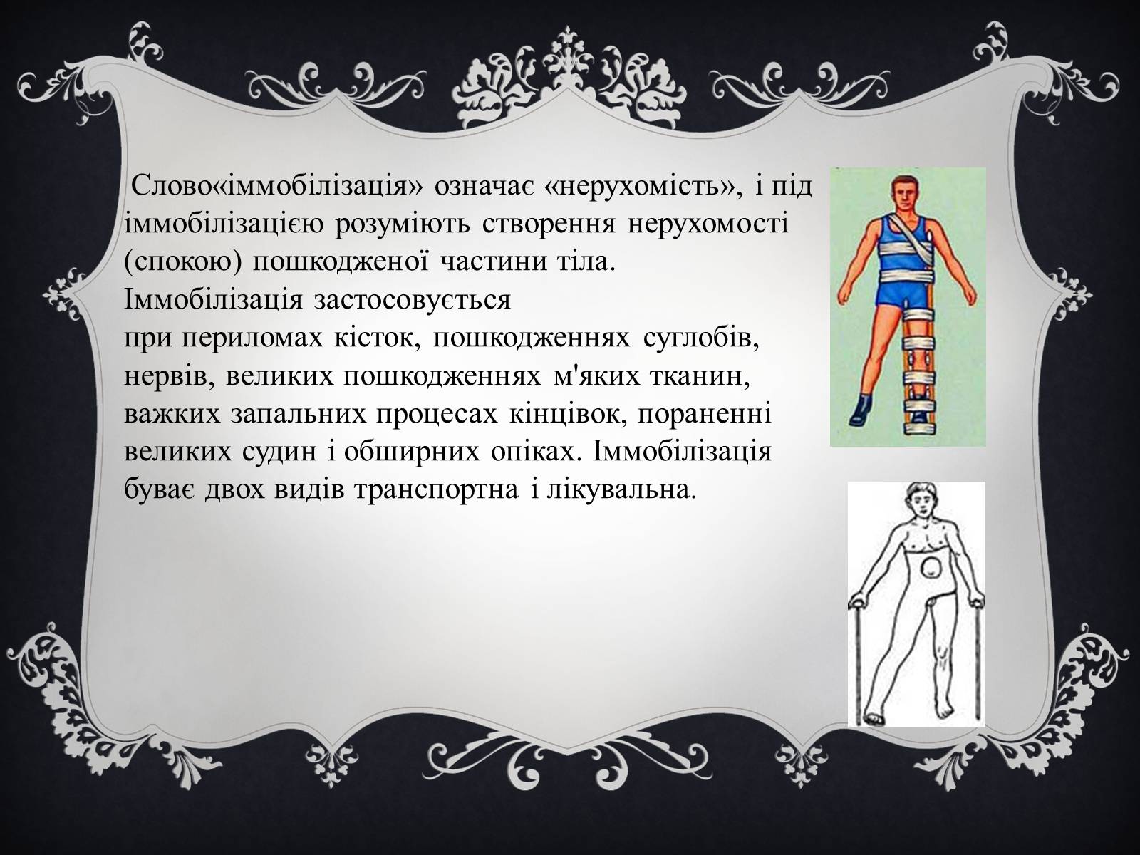 Презентація на тему «Іммобілізація пошкодженої ділянки тіла людини» - Слайд #3 Презентація на тему «Іммобілізація пошкодженої ділянки тіла людини» - Слайд #3