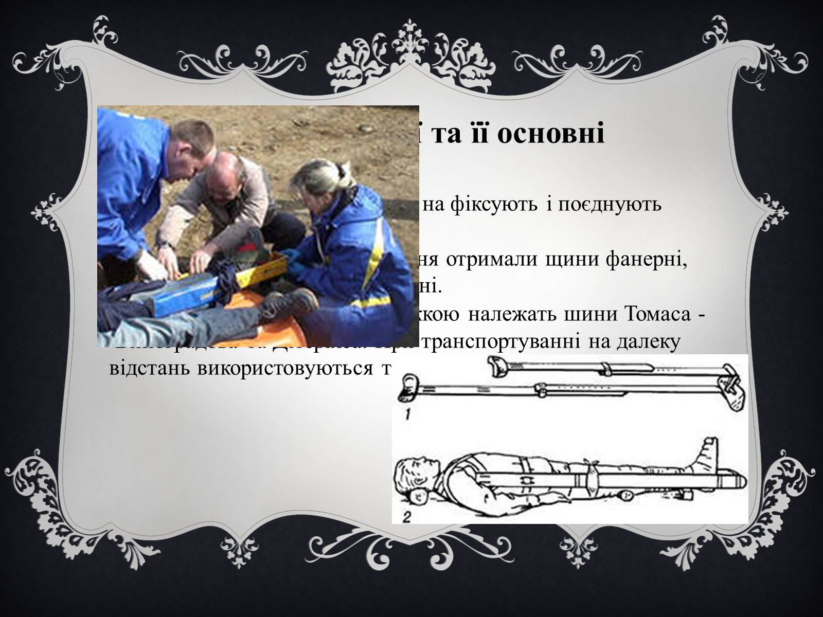 Презентація на тему «Іммобілізація пошкодженої ділянки тіла людини» - Слайд #4 Презентація на тему «Іммобілізація пошкодженої ділянки тіла людини» - Слайд #4