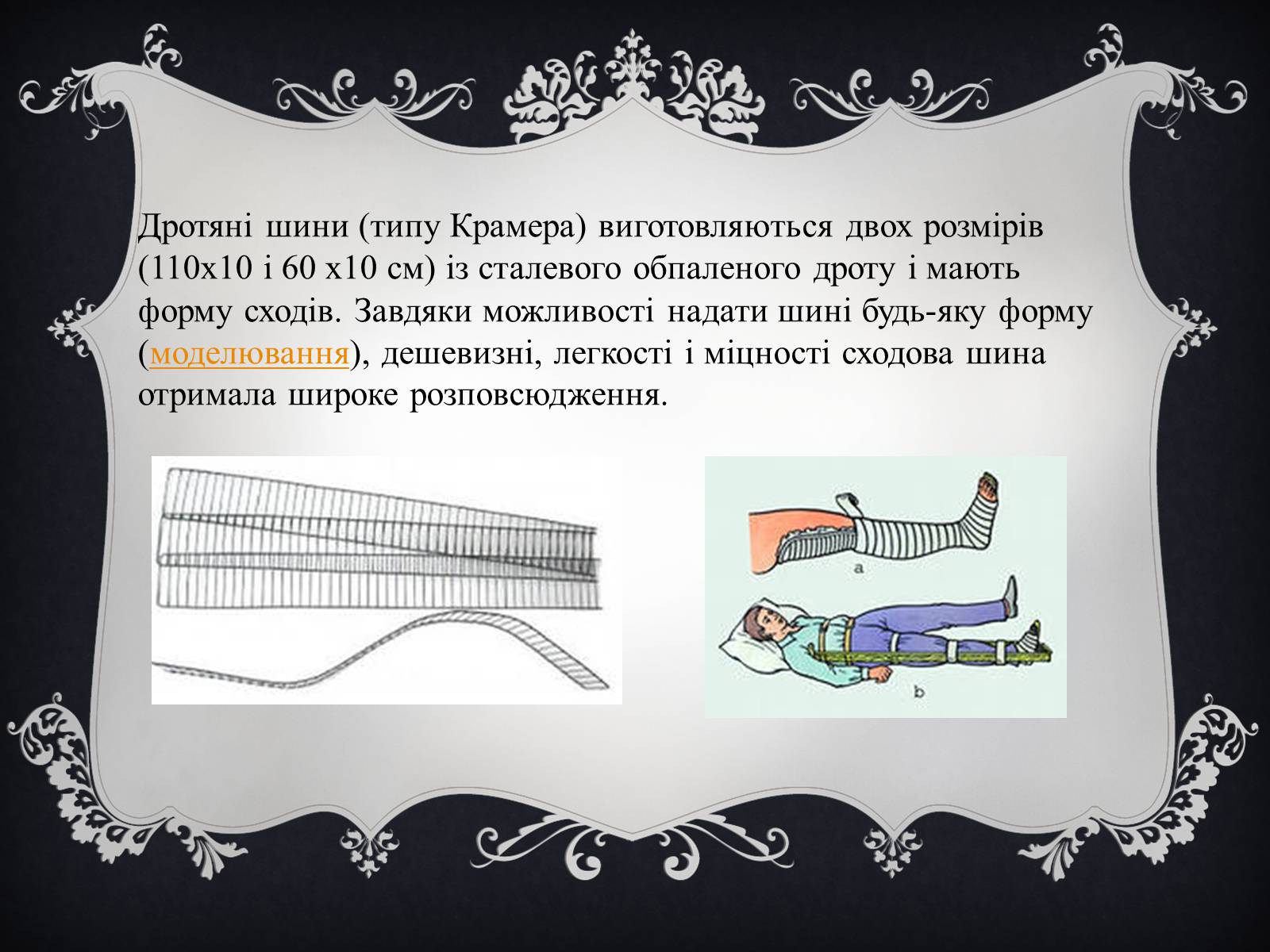 Презентація на тему «Іммобілізація пошкодженої ділянки тіла людини» - Слайд #5 Презентація на тему «Іммобілізація пошкодженої ділянки тіла людини» - Слайд #5