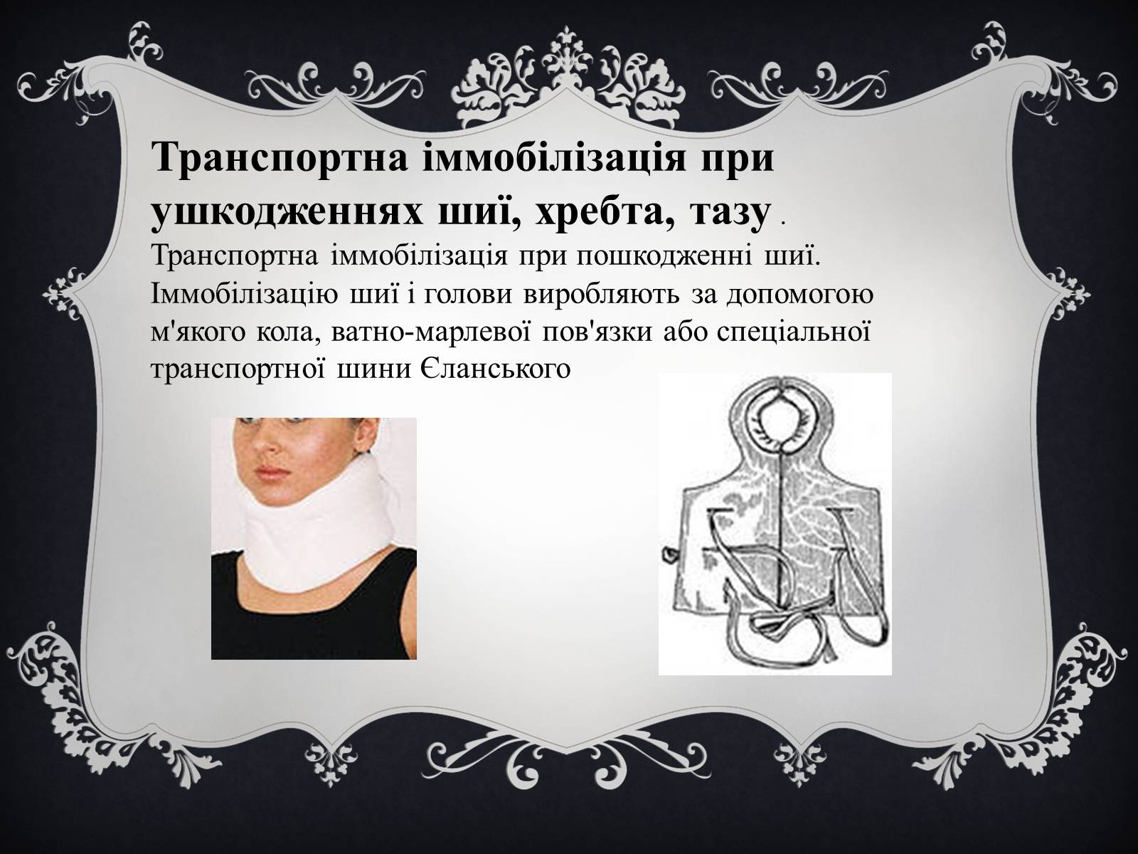 Презентація на тему «Іммобілізація пошкодженої ділянки тіла людини» - Слайд #6 Презентація на тему «Іммобілізація пошкодженої ділянки тіла людини» - Слайд #6