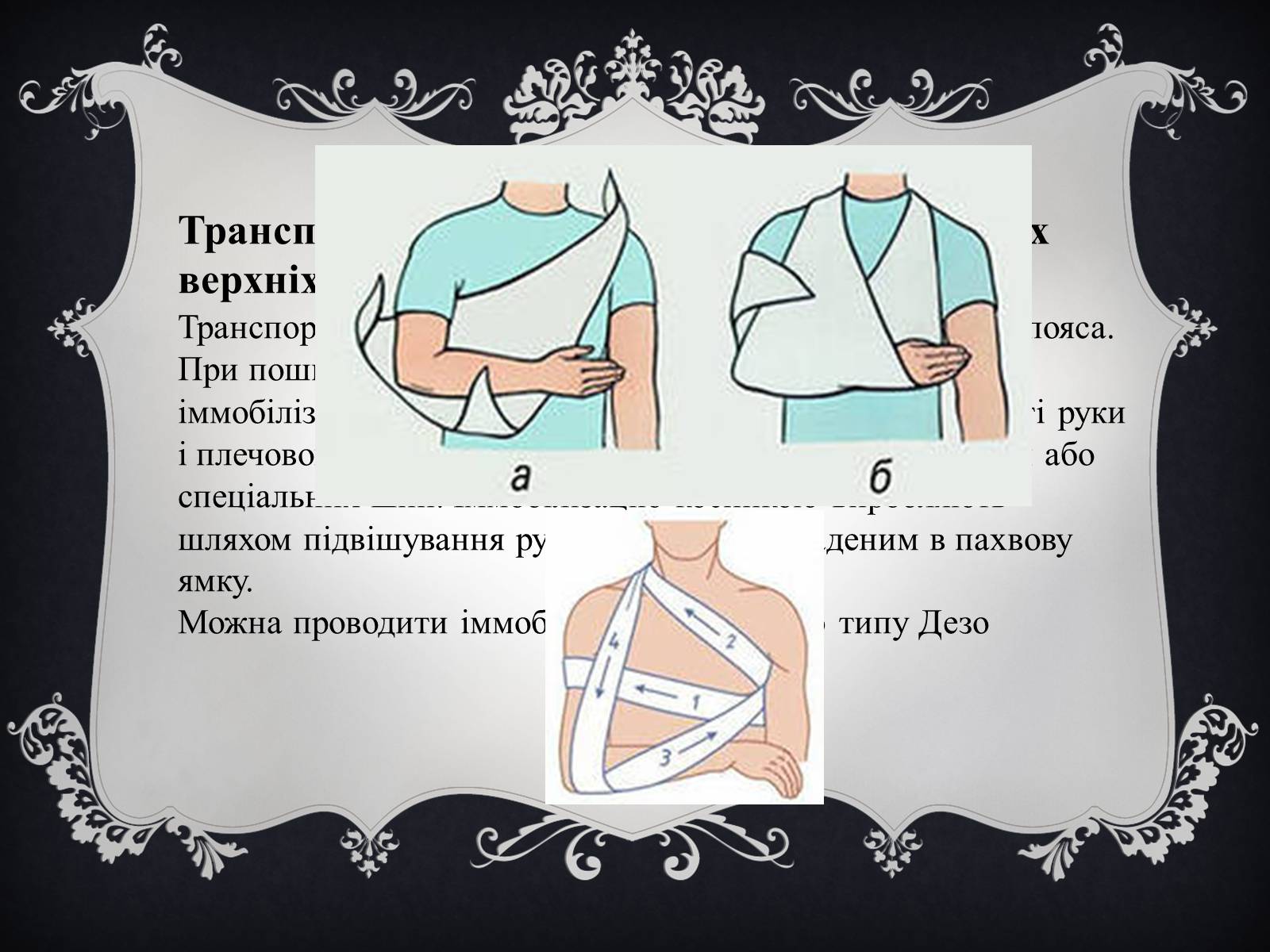 Презентація на тему «Іммобілізація пошкодженої ділянки тіла людини» - Слайд #7 Презентація на тему «Іммобілізація пошкодженої ділянки тіла людини» - Слайд #7