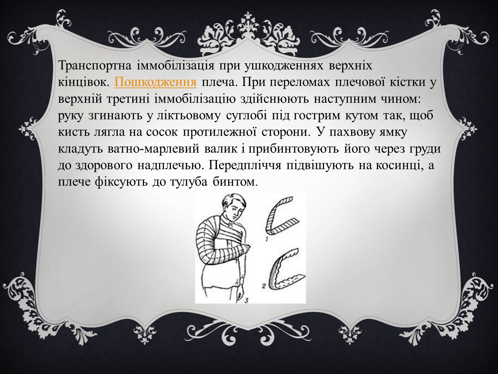 Презентація на тему «Іммобілізація пошкодженої ділянки тіла людини» - Слайд #9 Презентація на тему «Іммобілізація пошкодженої ділянки тіла людини» - Слайд #9