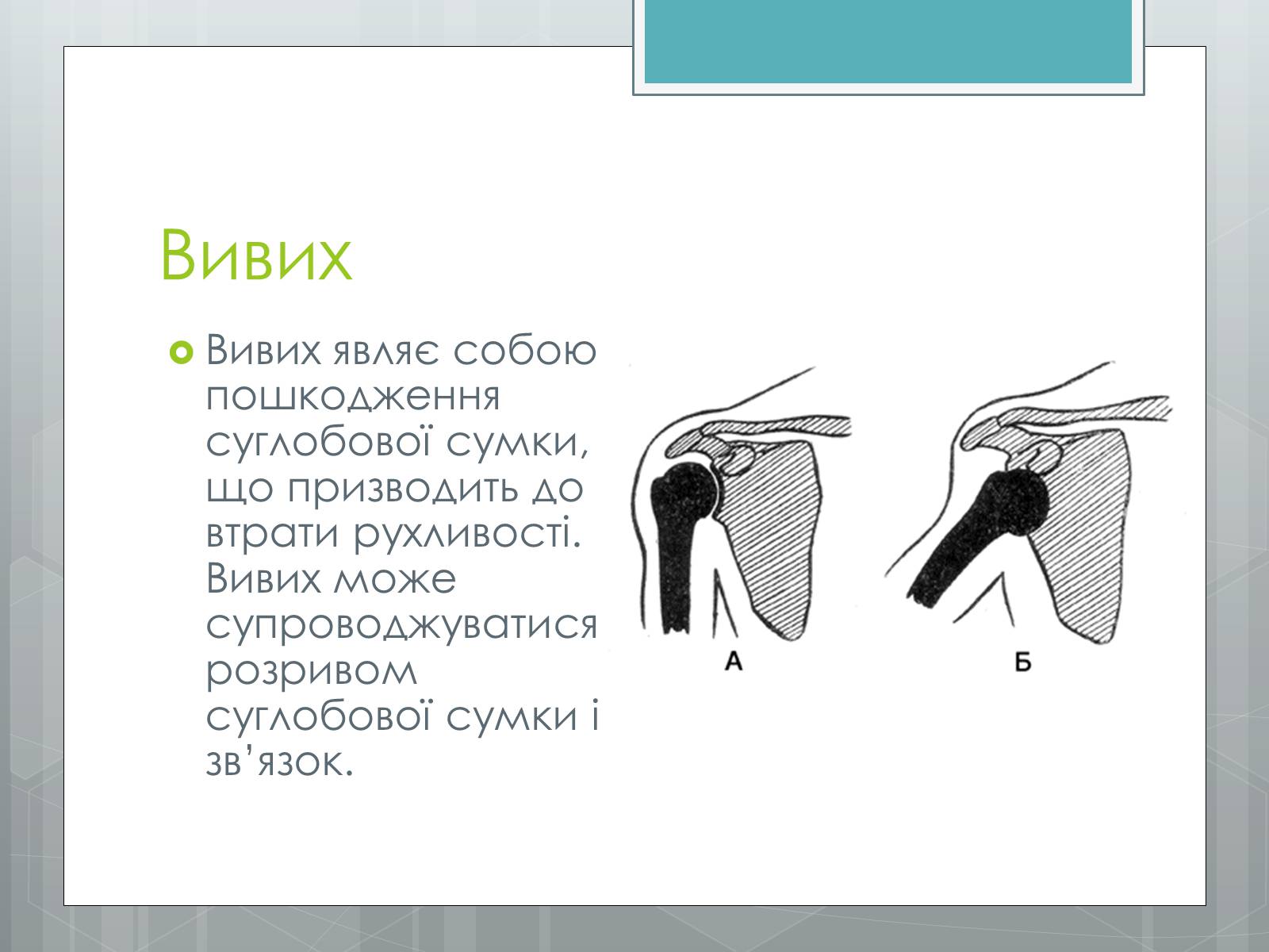 Презентація на тему «Вивихи, удари, розтягнення» - Слайд #2 Презентація на тему «Вивихи, удари, розтягнення» - Слайд #2