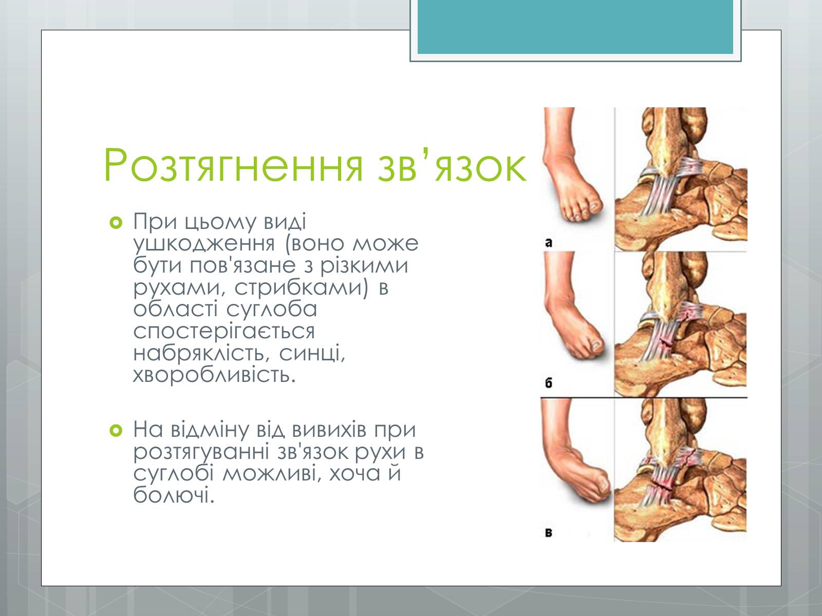 Презентація на тему «Вивихи, удари, розтягнення» - Слайд #5 Презентація на тему «Вивихи, удари, розтягнення» - Слайд #5