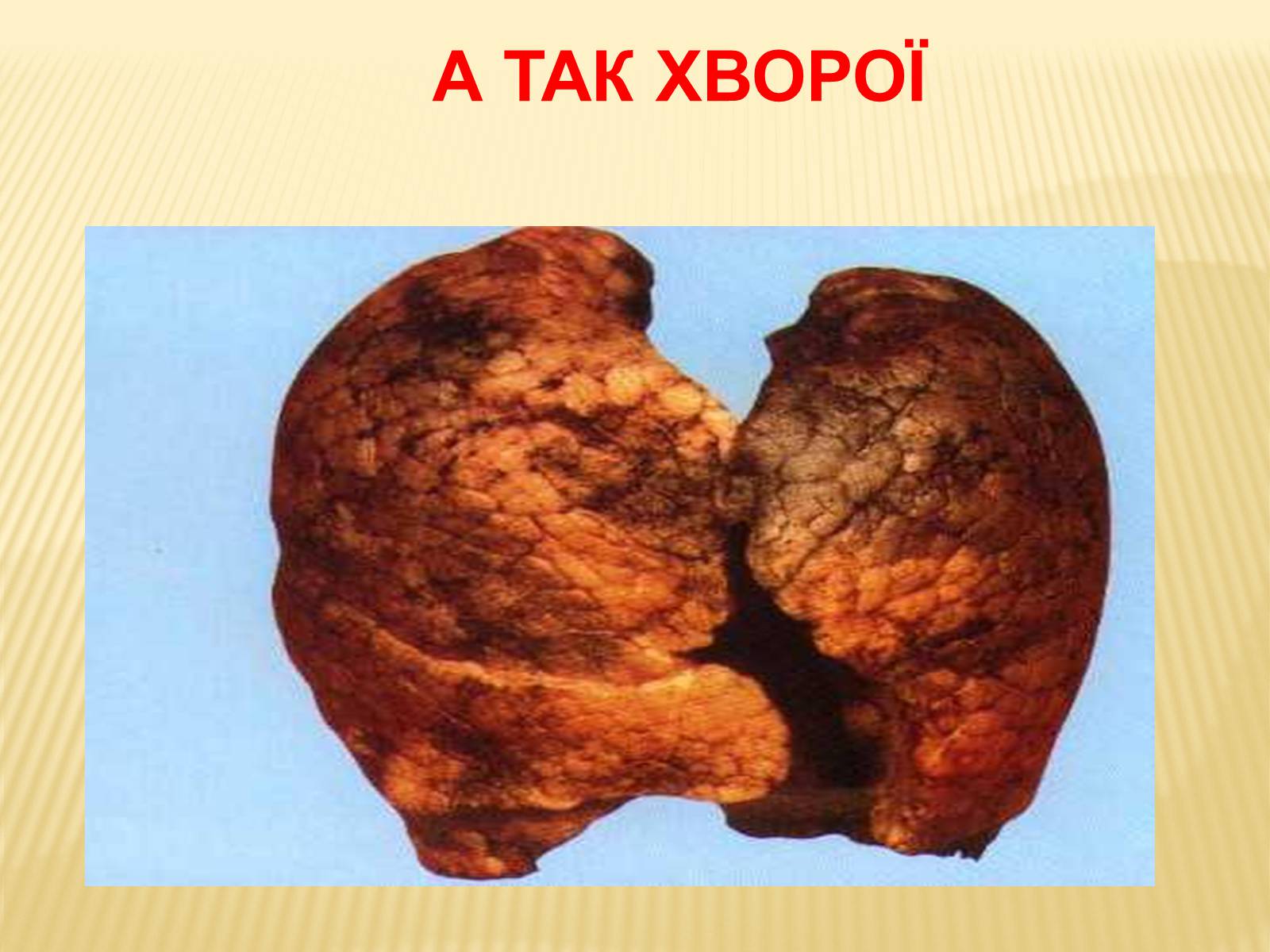 Презентація на тему «Тютюн» (варіант 1) - Слайд #14 Презентація на тему «Тютюн» (варіант 1) - Слайд #14