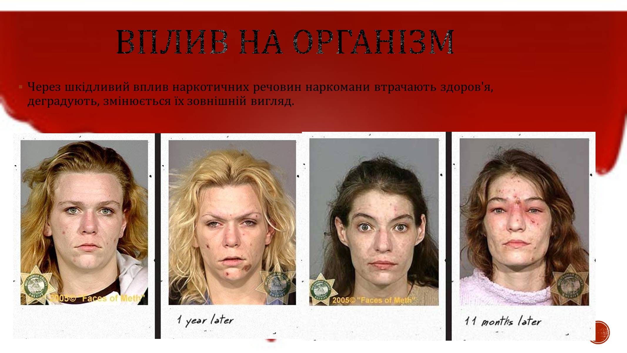 Презентація на тему «Наркотики» (варіант 4) - Слайд #7 Презентація на тему «Наркотики» (варіант 4) - Слайд #7