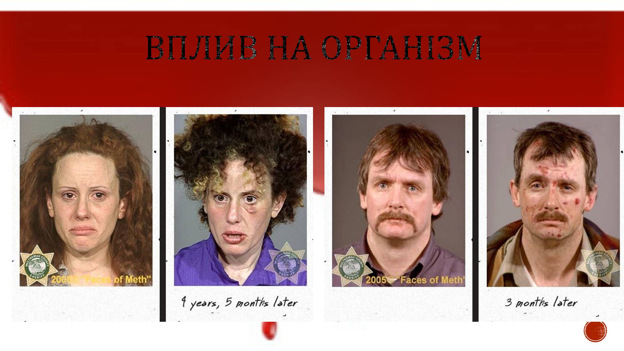 Презентація на тему «Наркотики» (варіант 4) - Слайд #8 Презентація на тему «Наркотики» (варіант 4) - Слайд #8