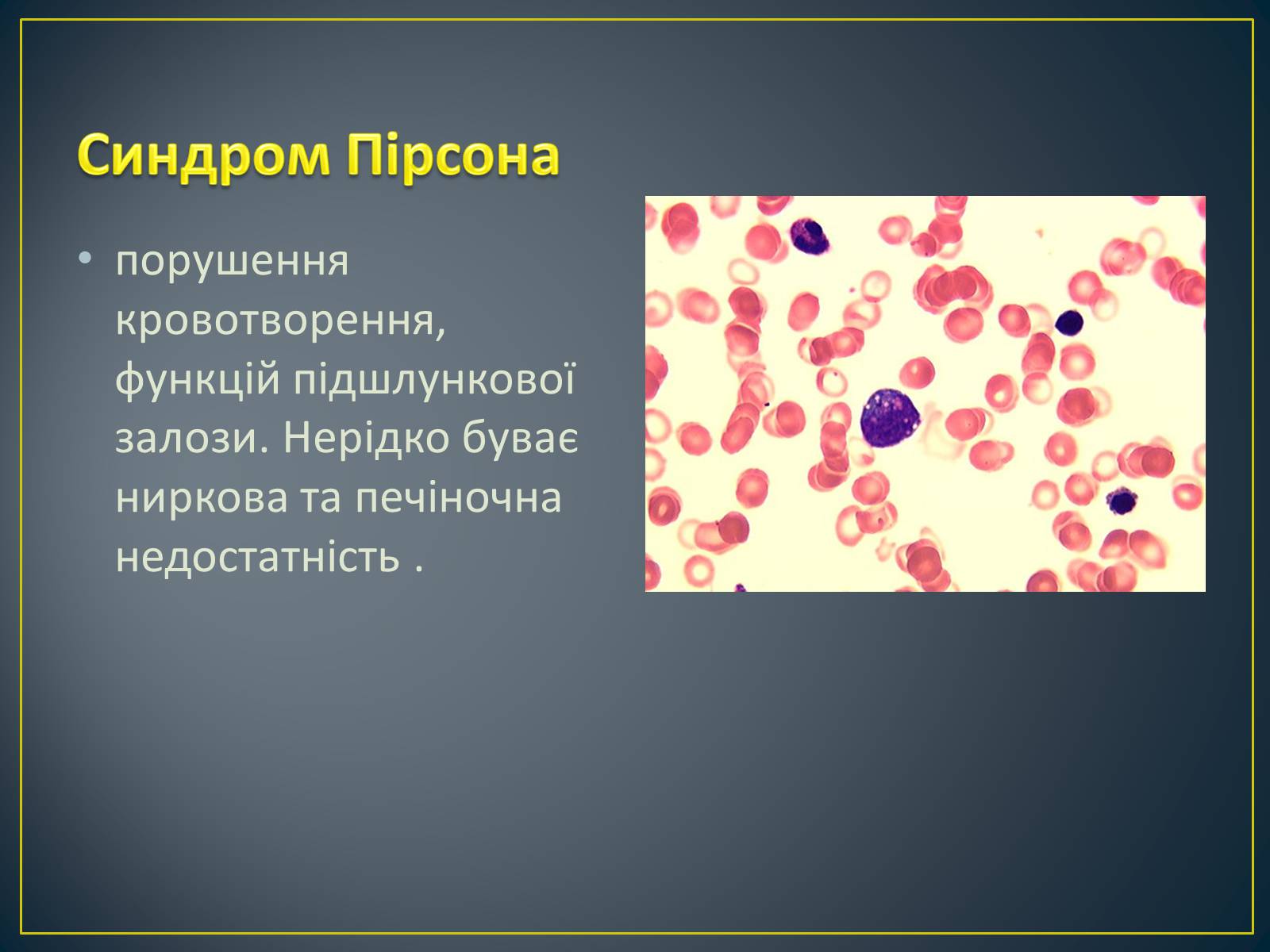 Презентація на тему «Типи генетичних хвороб людини» (варіант 2) - Слайд #22 Презентація на тему «Типи генетичних хвороб людини» (варіант 2) - Слайд #22