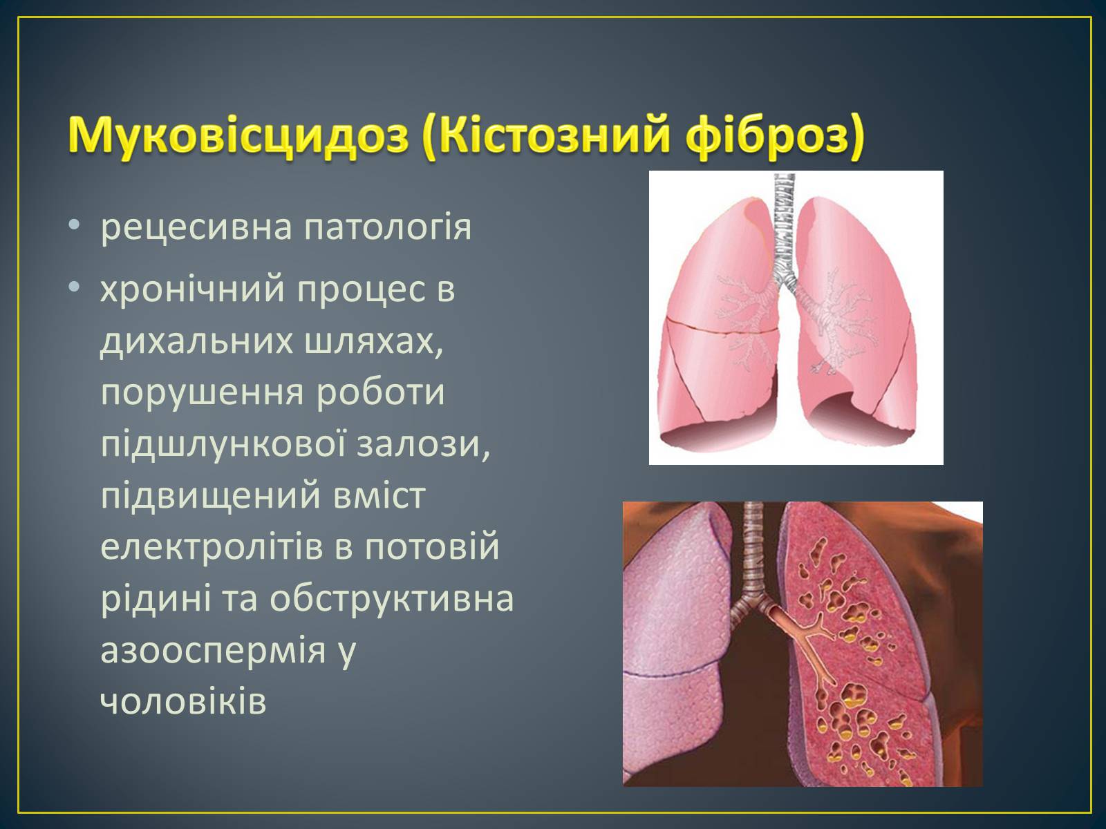 Презентація на тему «Типи генетичних хвороб людини» (варіант 2) - Слайд #3 Презентація на тему «Типи генетичних хвороб людини» (варіант 2) - Слайд #3
