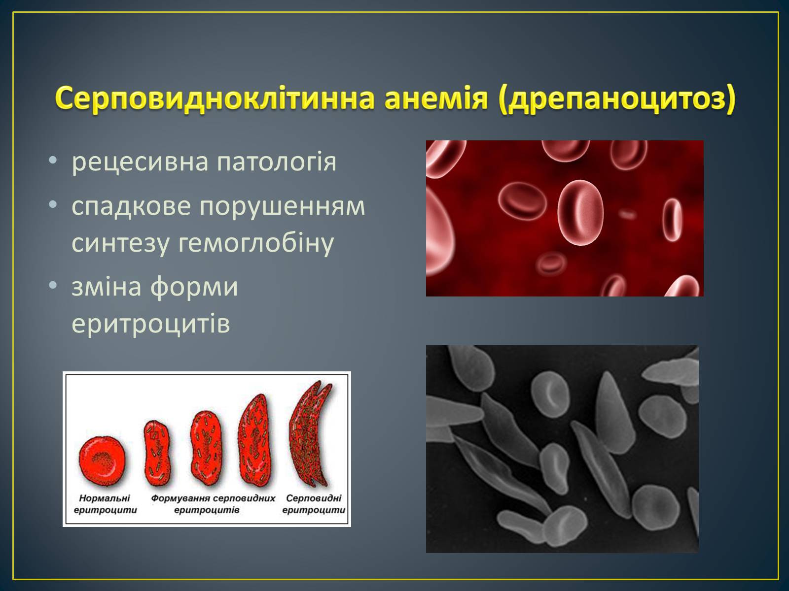 Презентація на тему «Типи генетичних хвороб людини» (варіант 2) - Слайд #4 Презентація на тему «Типи генетичних хвороб людини» (варіант 2) - Слайд #4