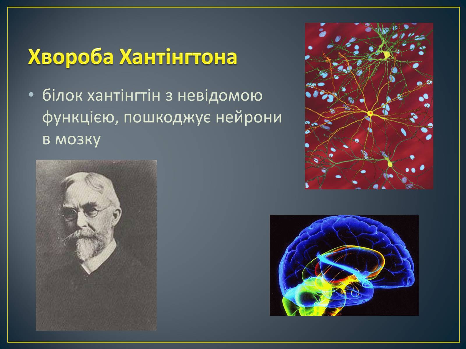 Презентація на тему «Типи генетичних хвороб людини» (варіант 2) - Слайд #5 Презентація на тему «Типи генетичних хвороб людини» (варіант 2) - Слайд #5
